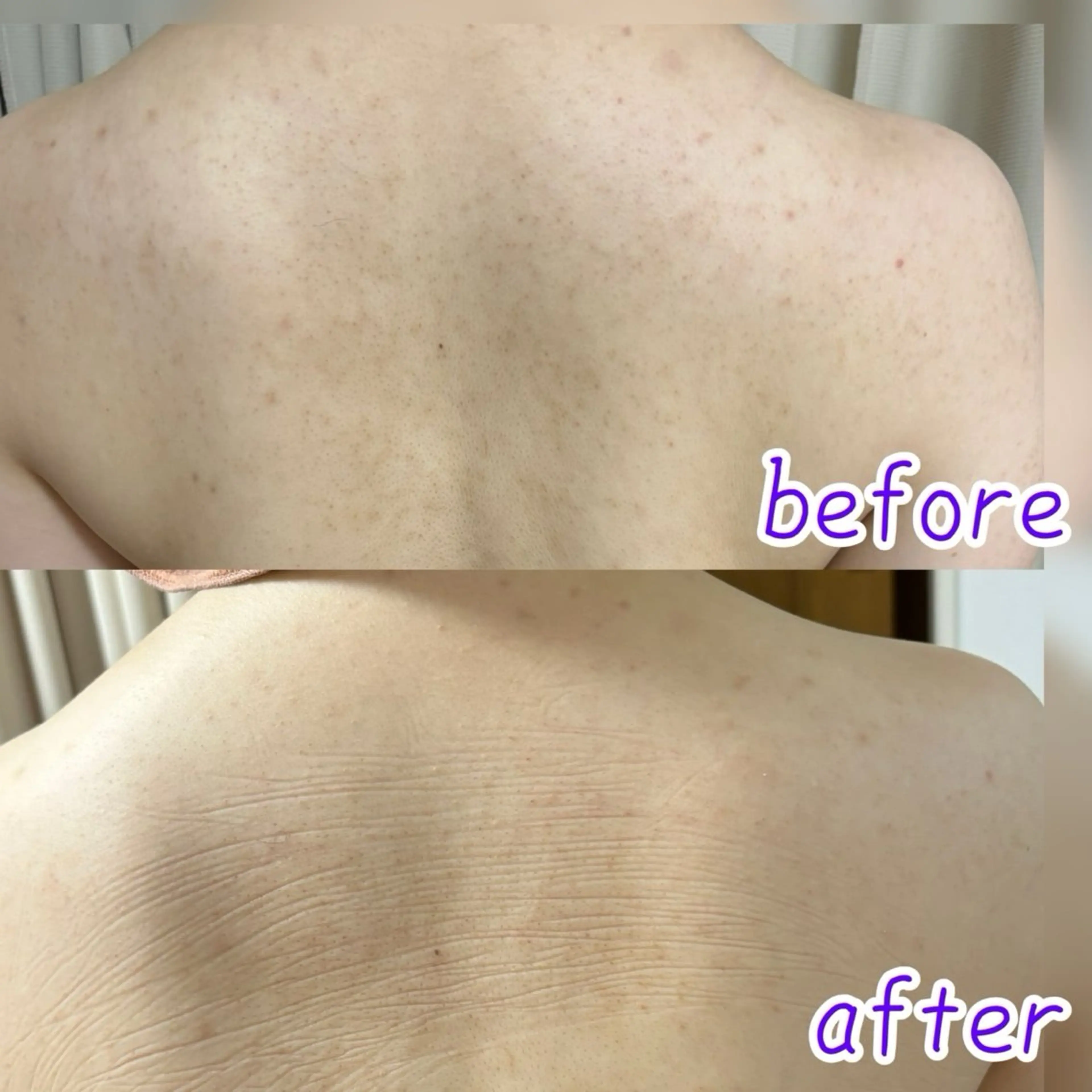 Linomalie エステ/たるみ/脱毛のエステ・リラクイメージ