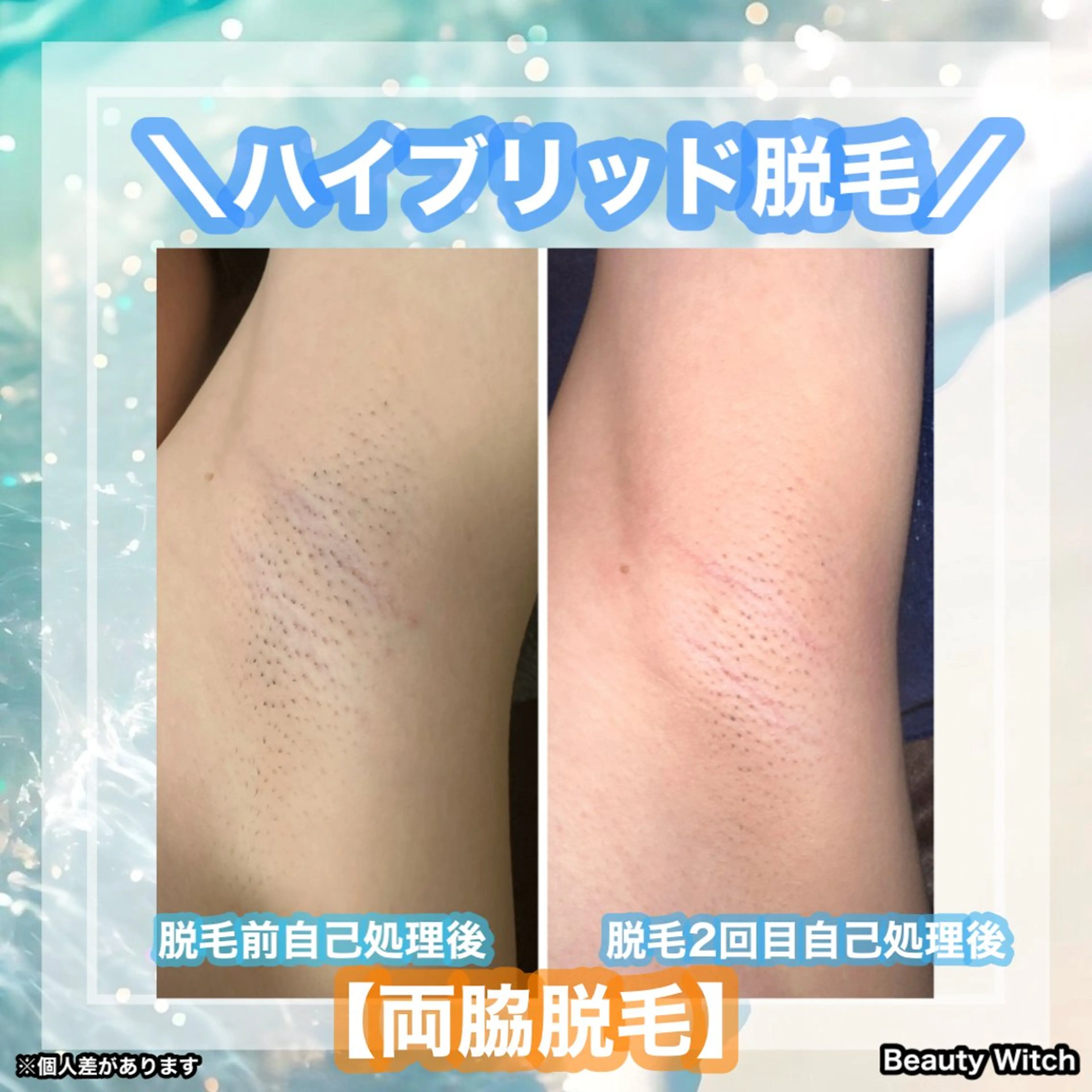 脱毛 痩身/脱毛/ネイル HARUKAのエステ・リラクイメージ