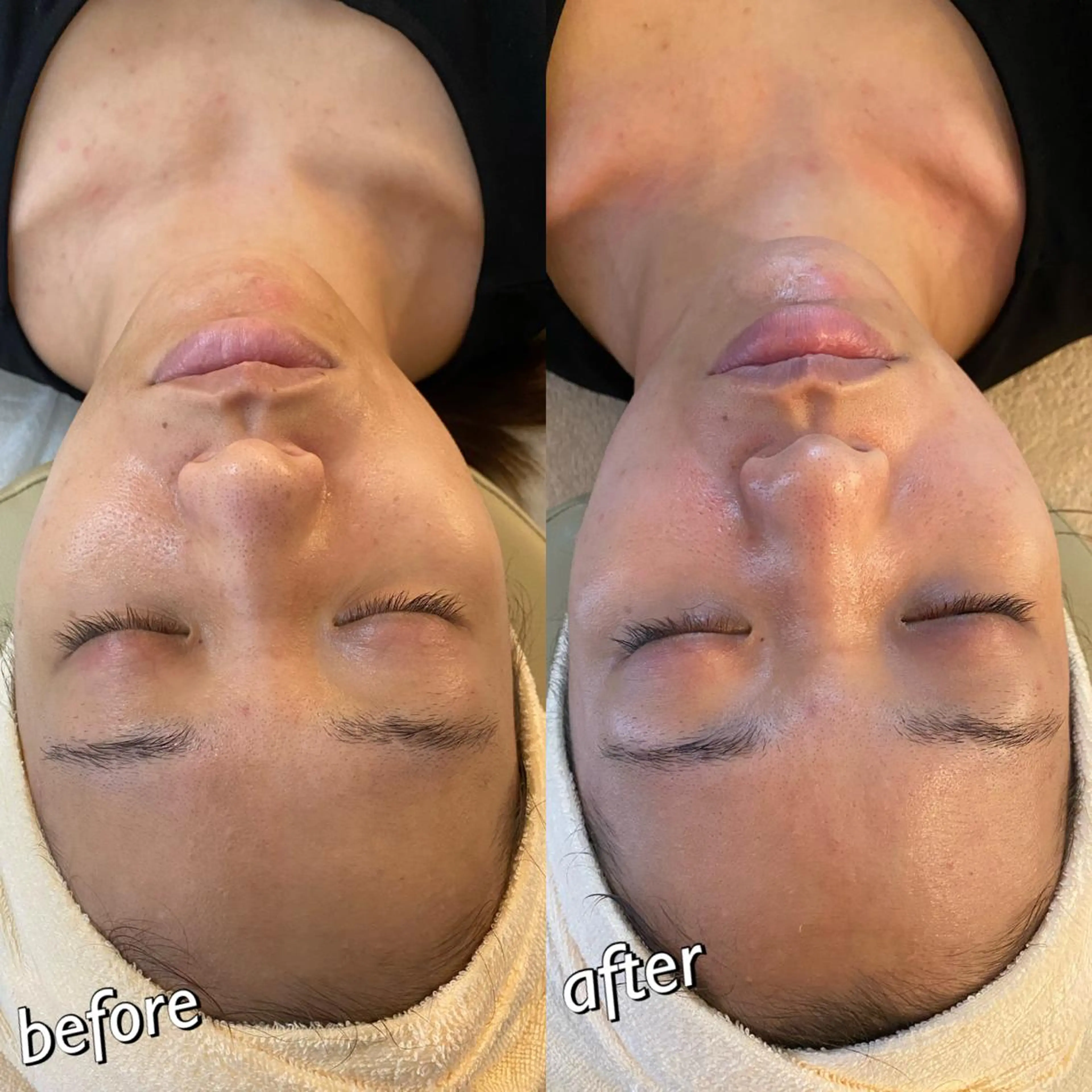 うなじ脱毛/美肌脱毛 LABELのエステ・リラクイメージ