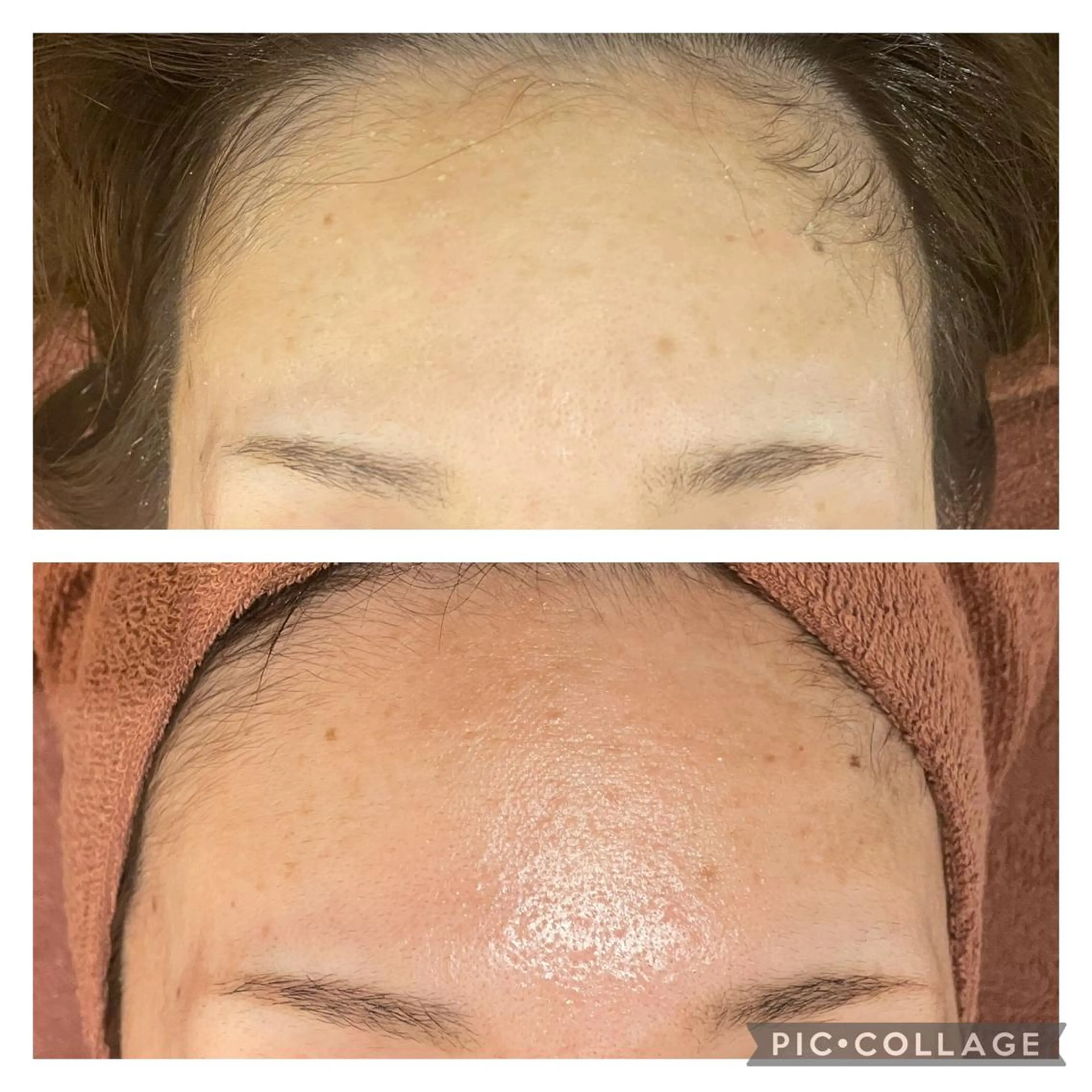 セミロング カラー パーマ ヘアアレンジ メンズ キッズ ネイル マツエク・マツパ アイブロウ ニキビ特化型エステ 🍋最短で肌質改善のエステ・リラクイメージ