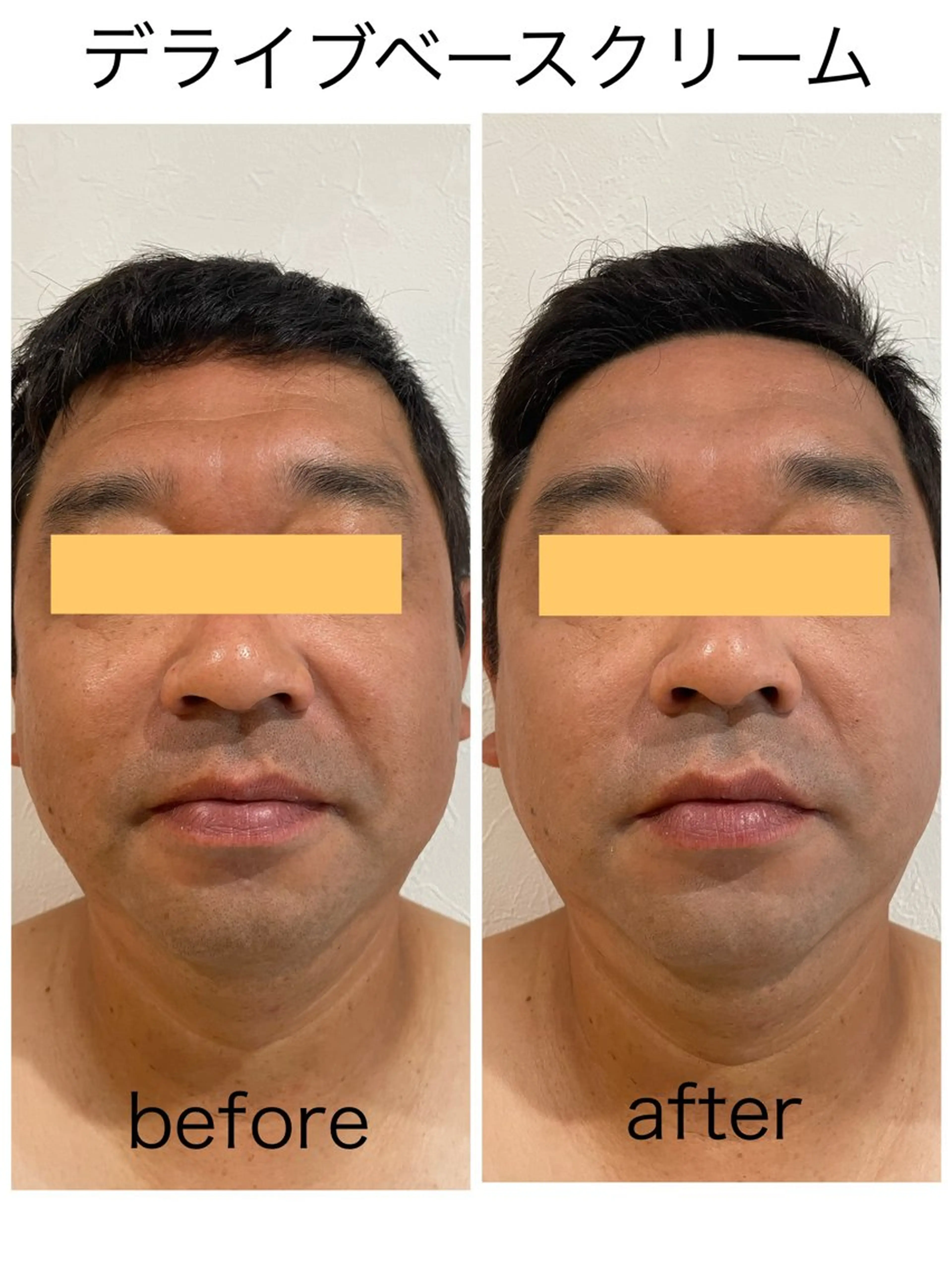 メンズ化粧品使用🆕フェイシャルケアの写真