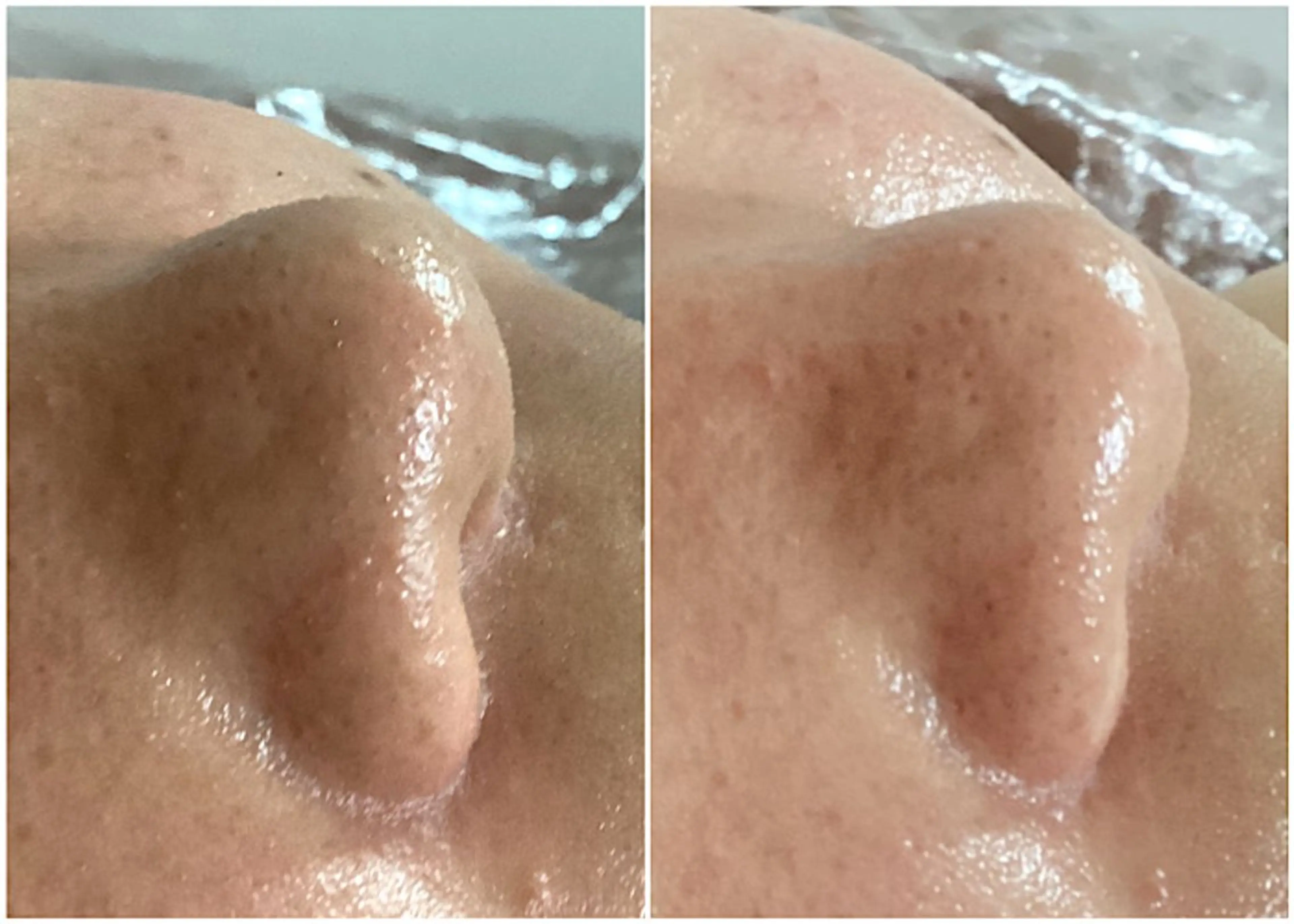 ize 横浜店のエステ・リラクイメージ