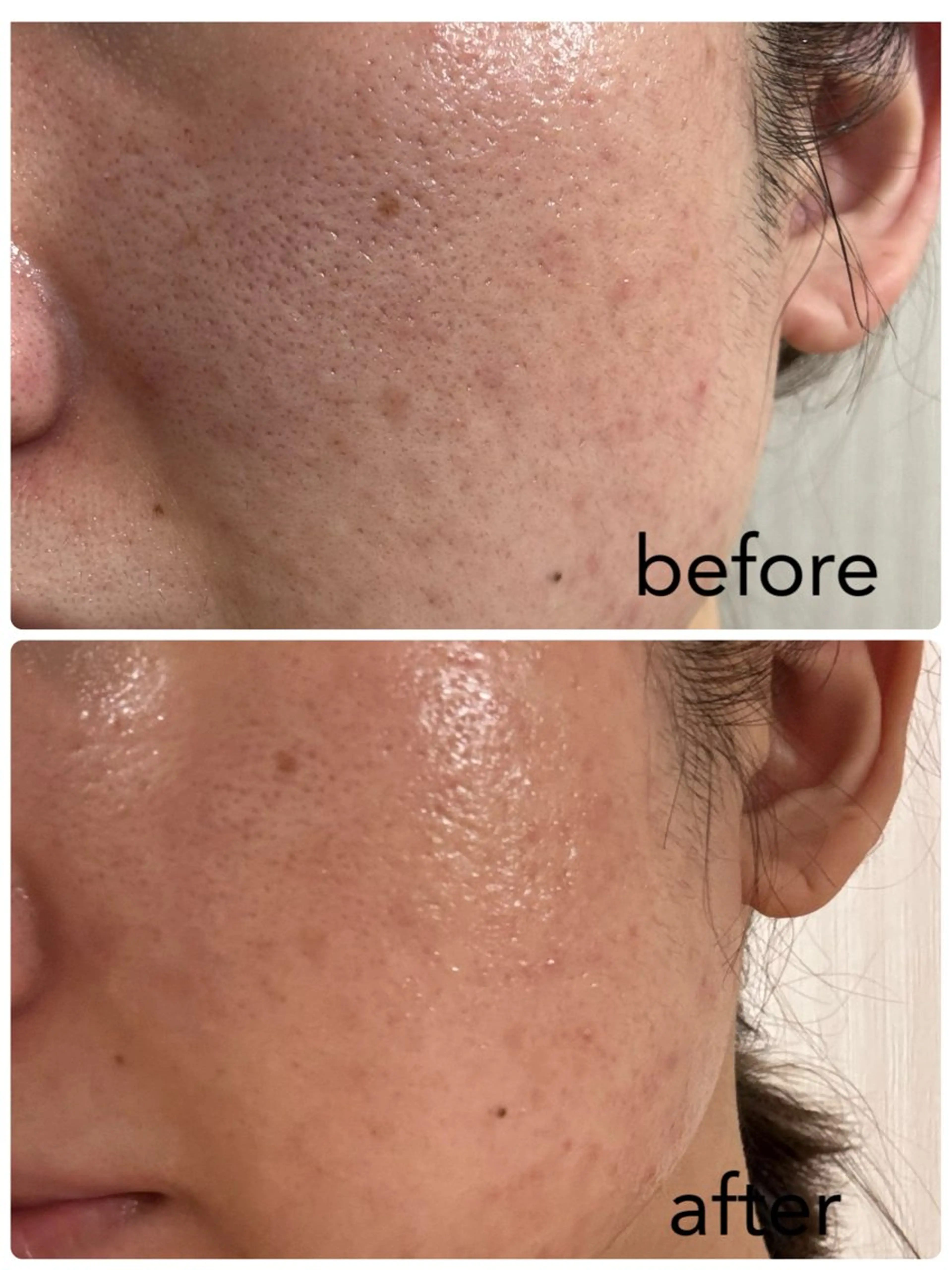 その他 IVY化粧品・ 勝山亜優奈のその他イメージ