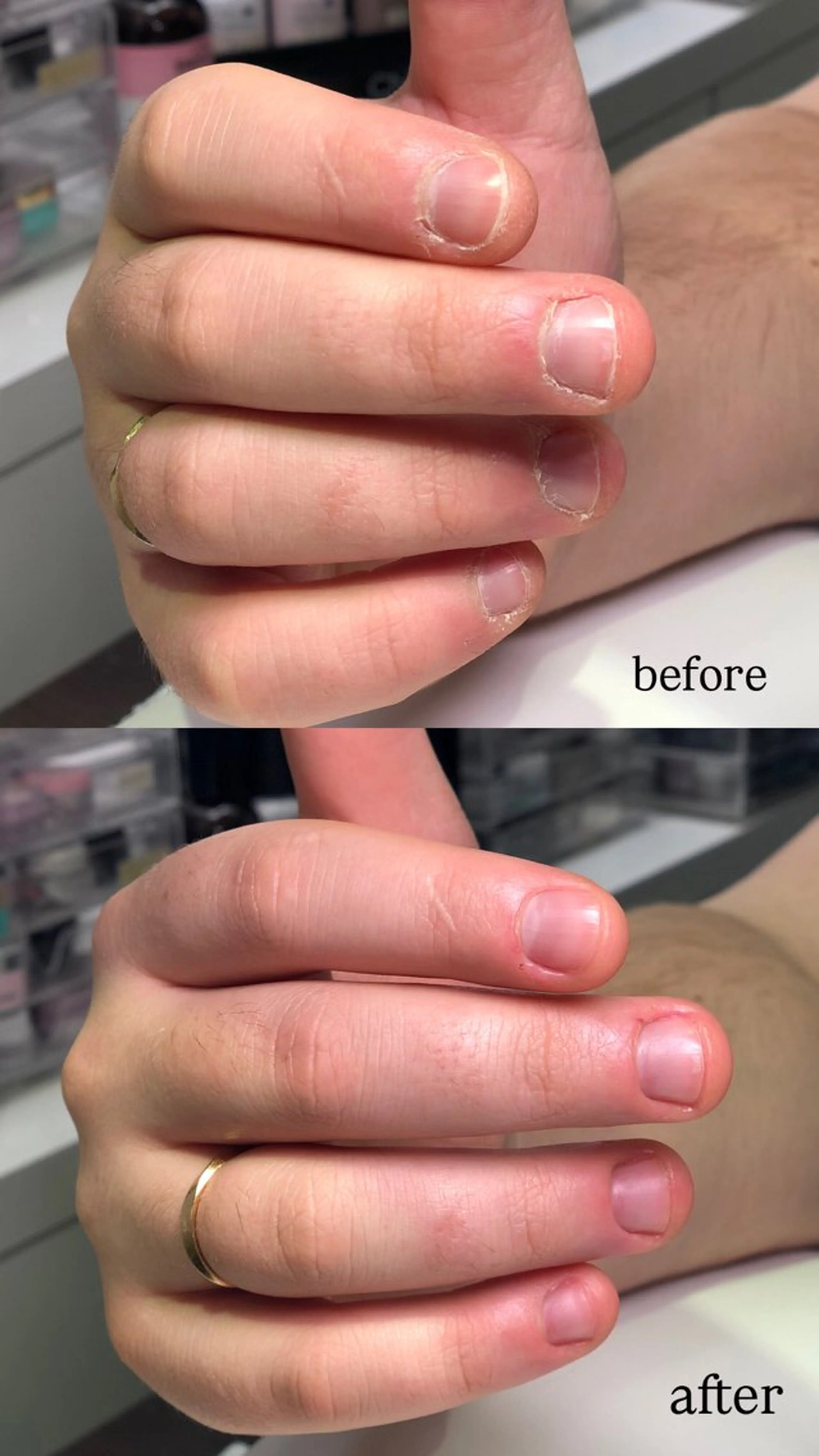 メンズハンドケア💙の写真