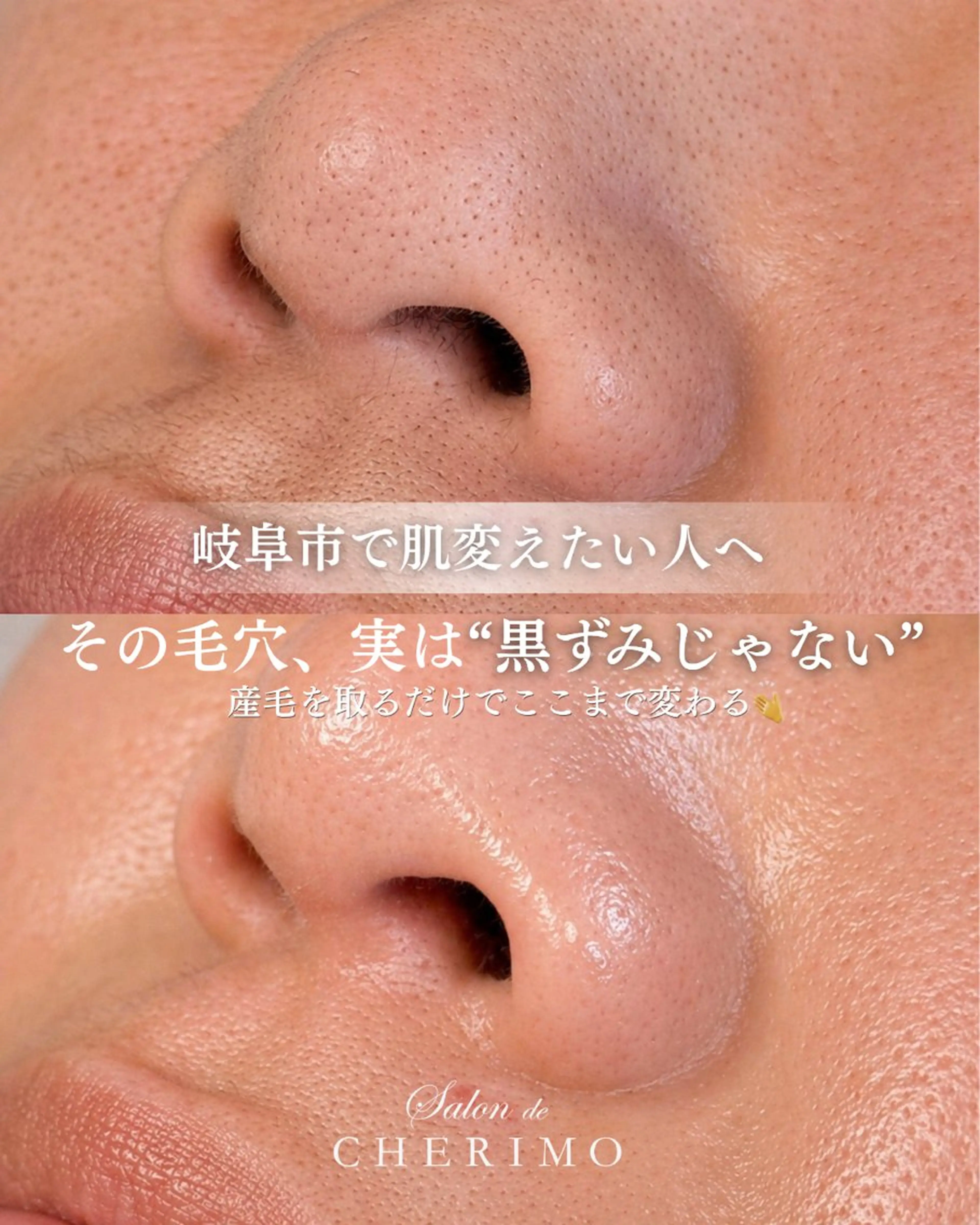 脱毛 林 恵利佳のエステ・リラクイメージ