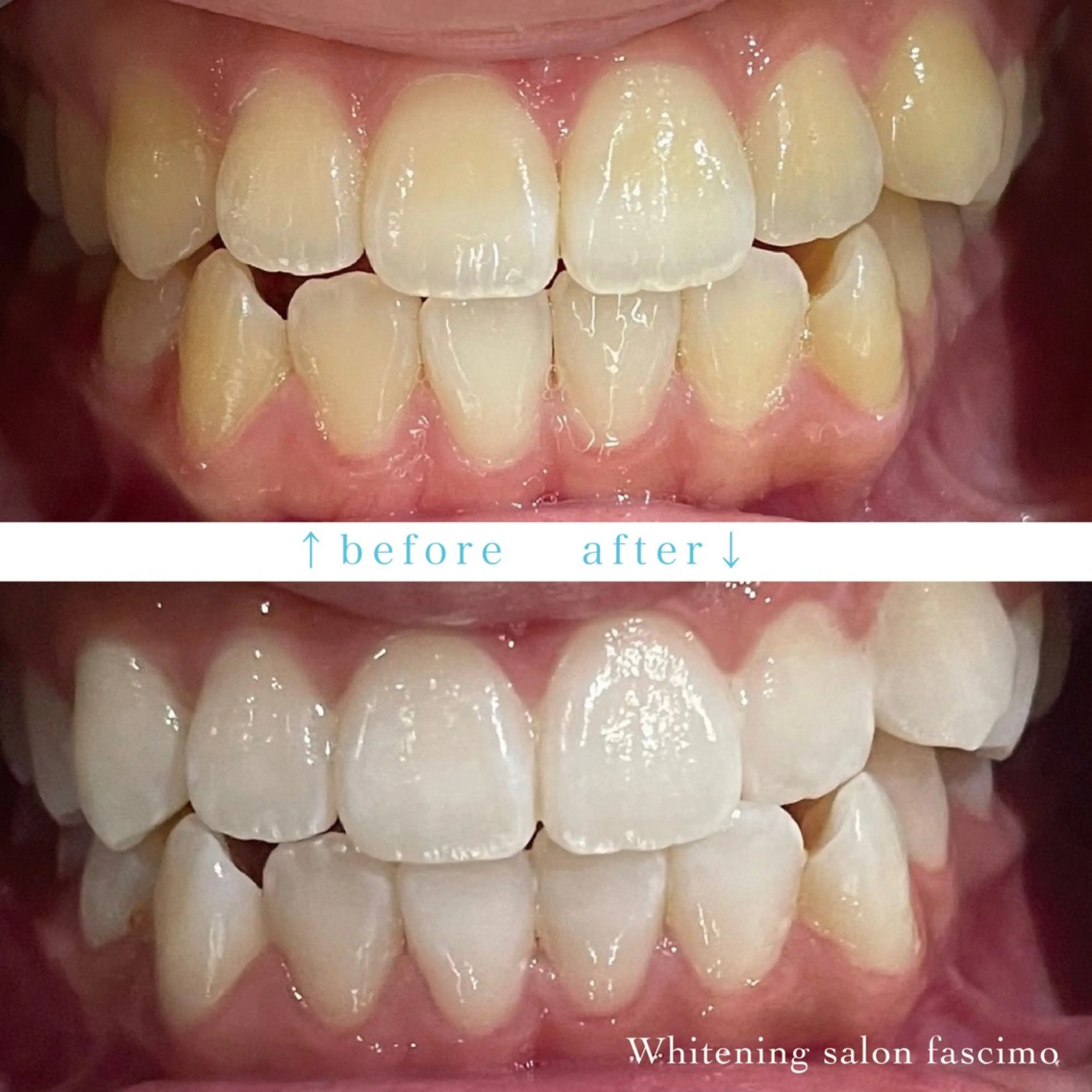 ホワイトニングサロン fascimo新座店のその他イメージ