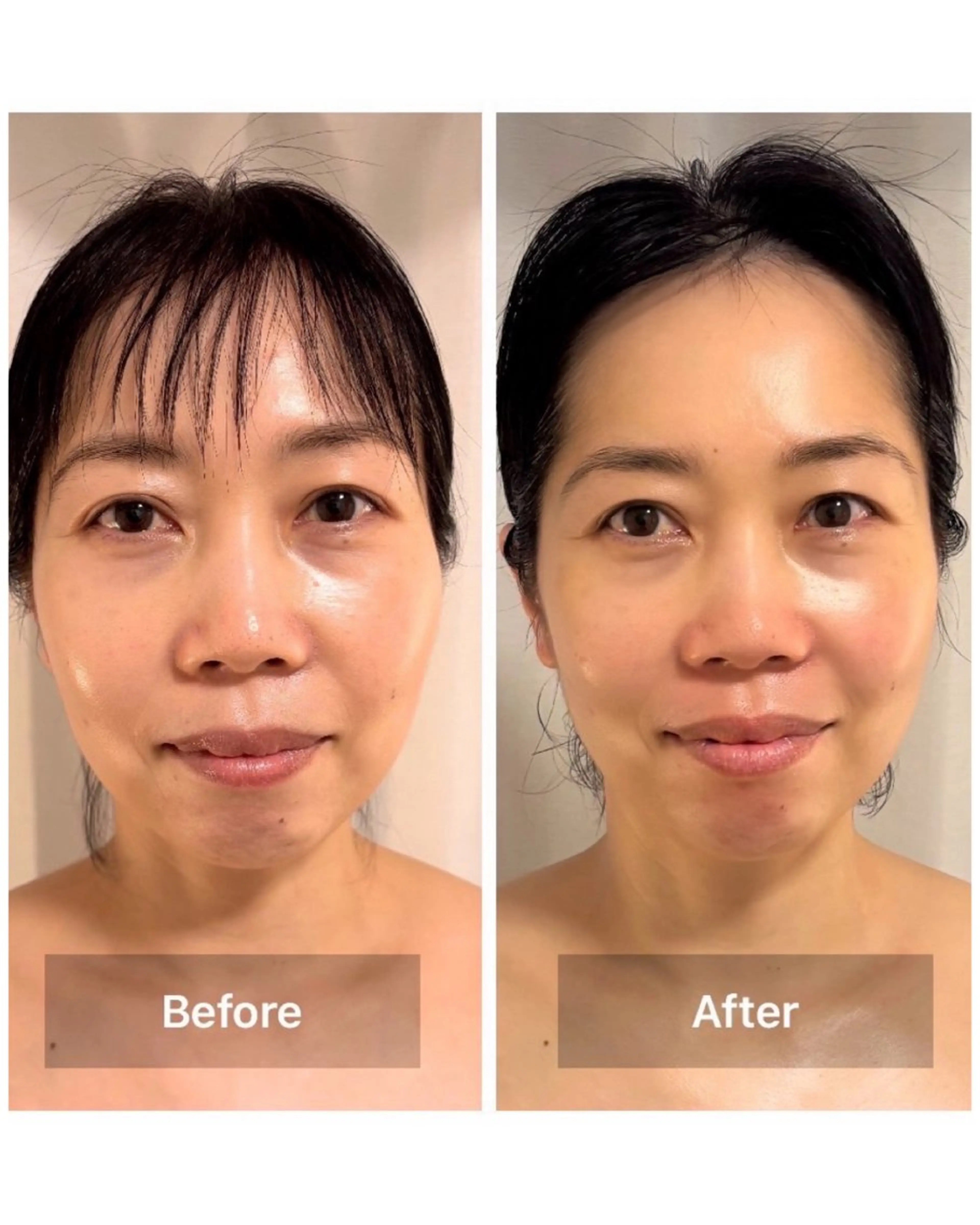 エステ リラク 小顔・たるみケア 専門店【LaLa】のエステ・リラクイメージ