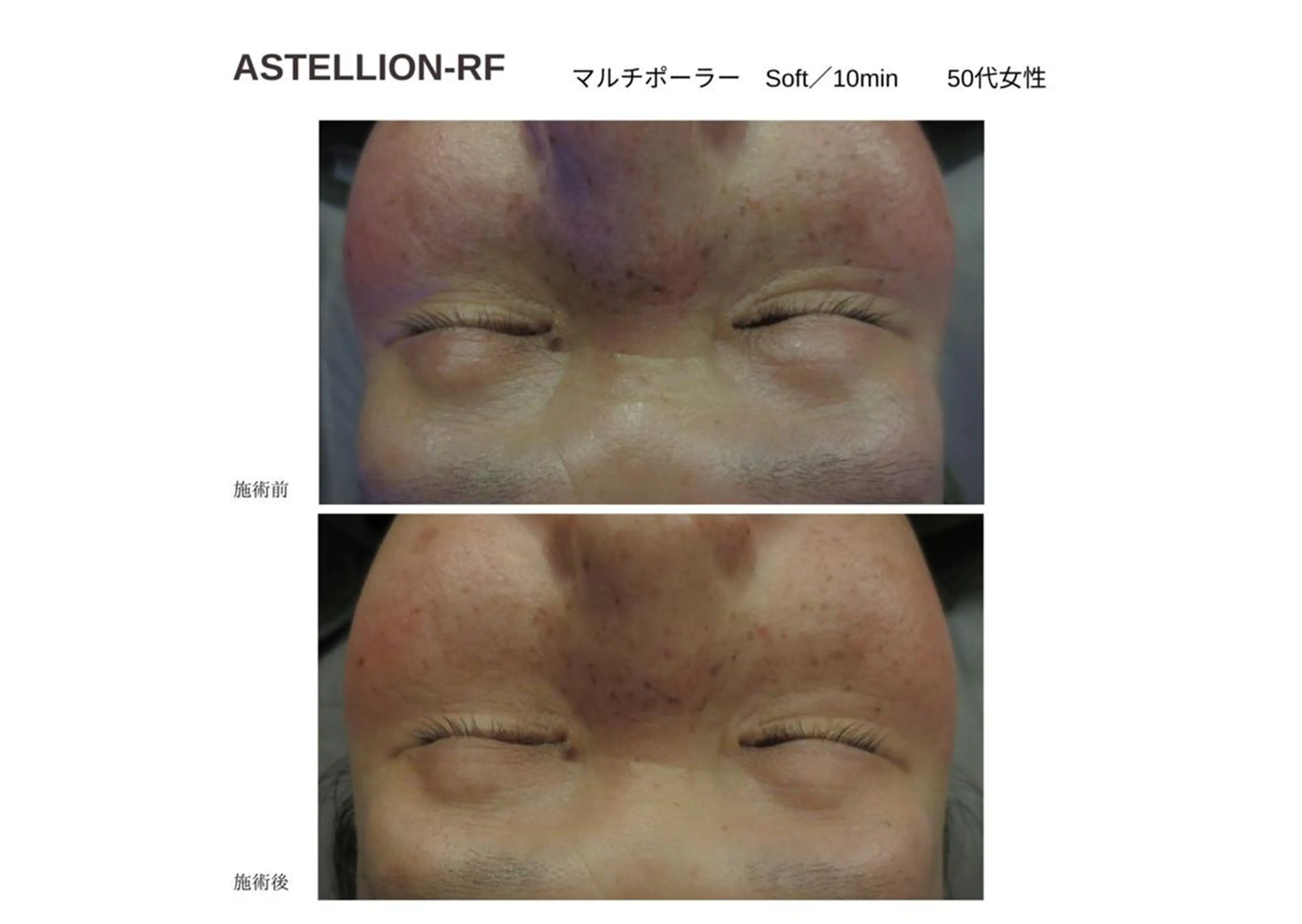 シルフィア｜ 小顔／深層マッサージのエステ・リラクイメージ