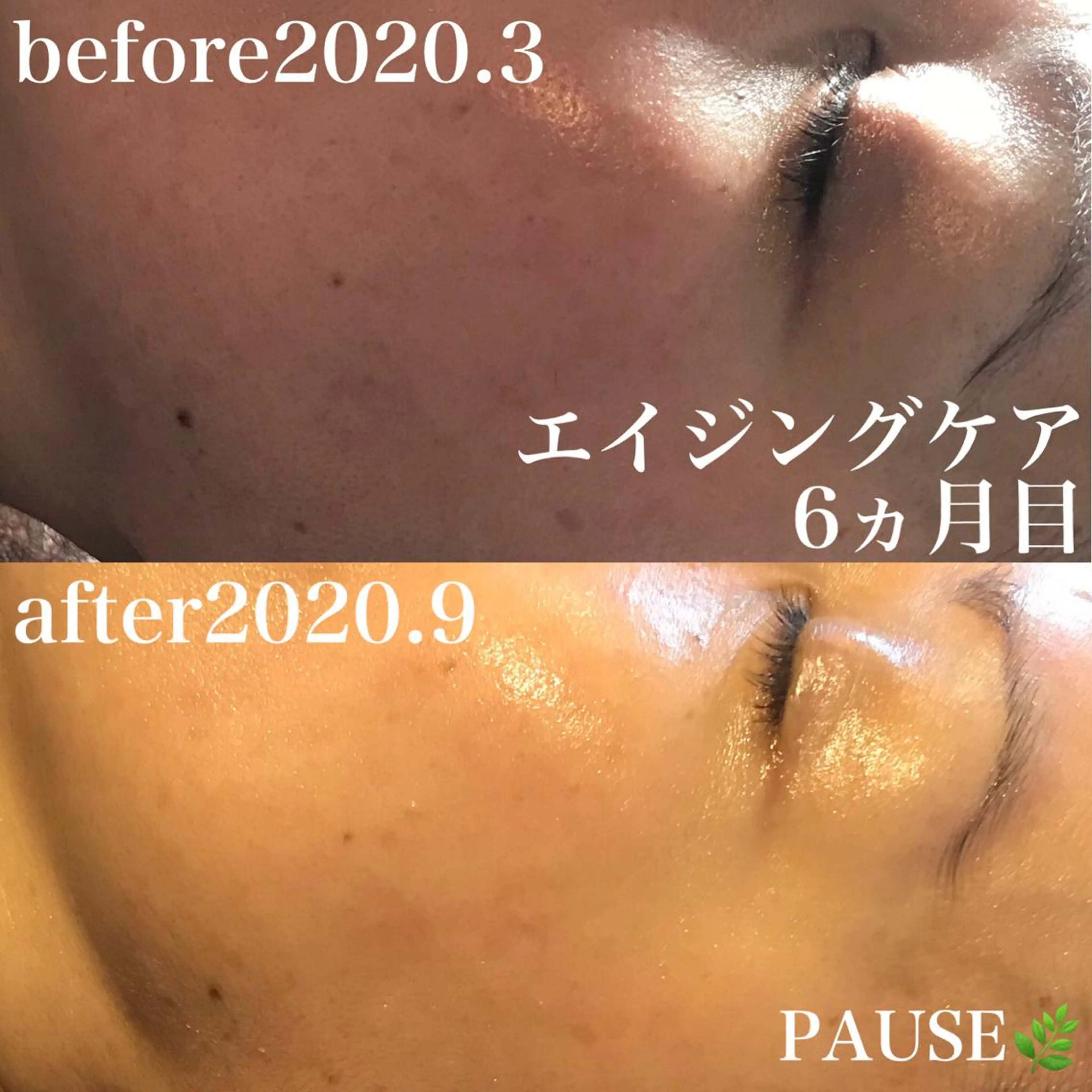 エステ 浜野 恵美のエステ・リラクイメージ