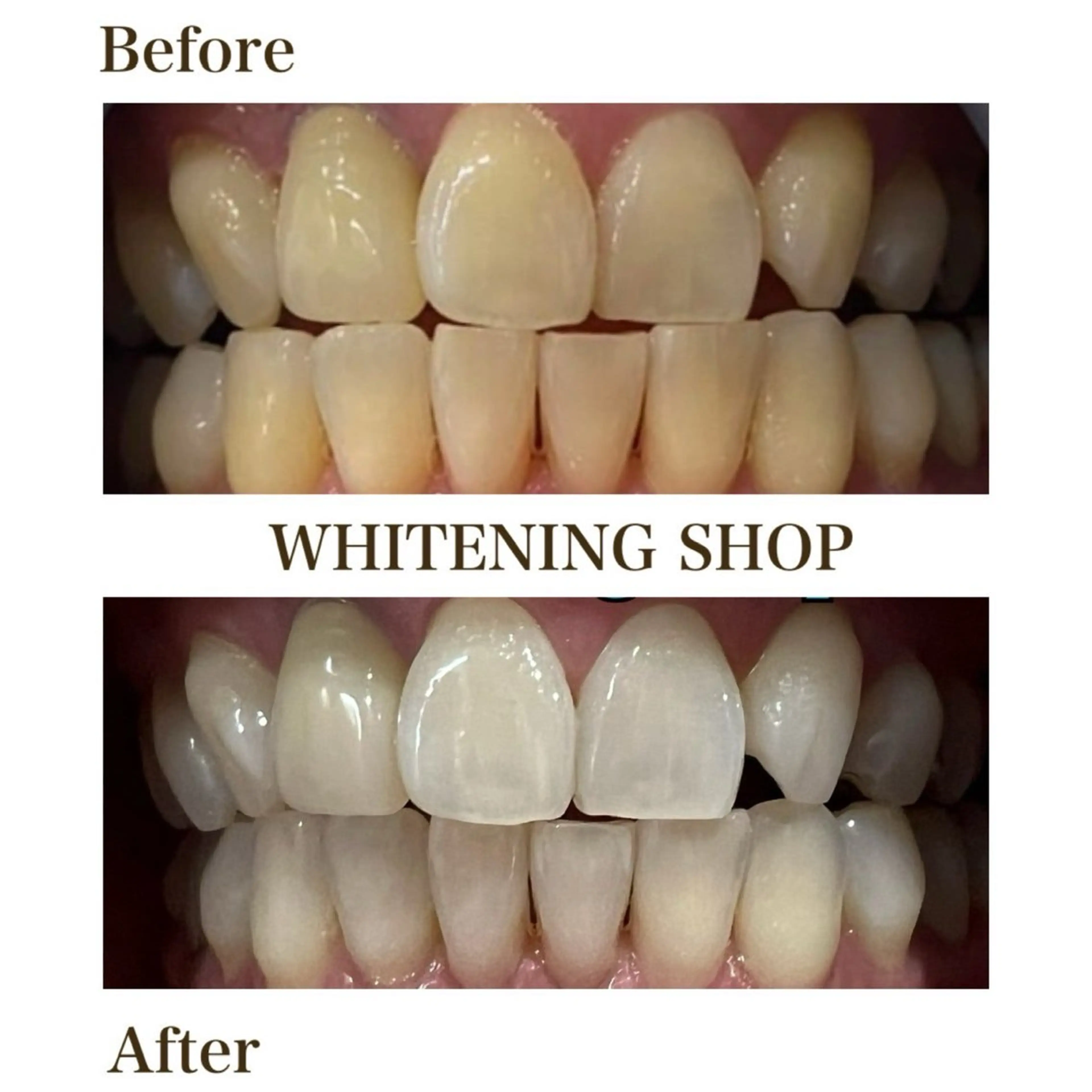 ホワイトニングショップ静岡葵区店所属・ホワイトニング ショップ葵区静岡駅店のその他イメージ