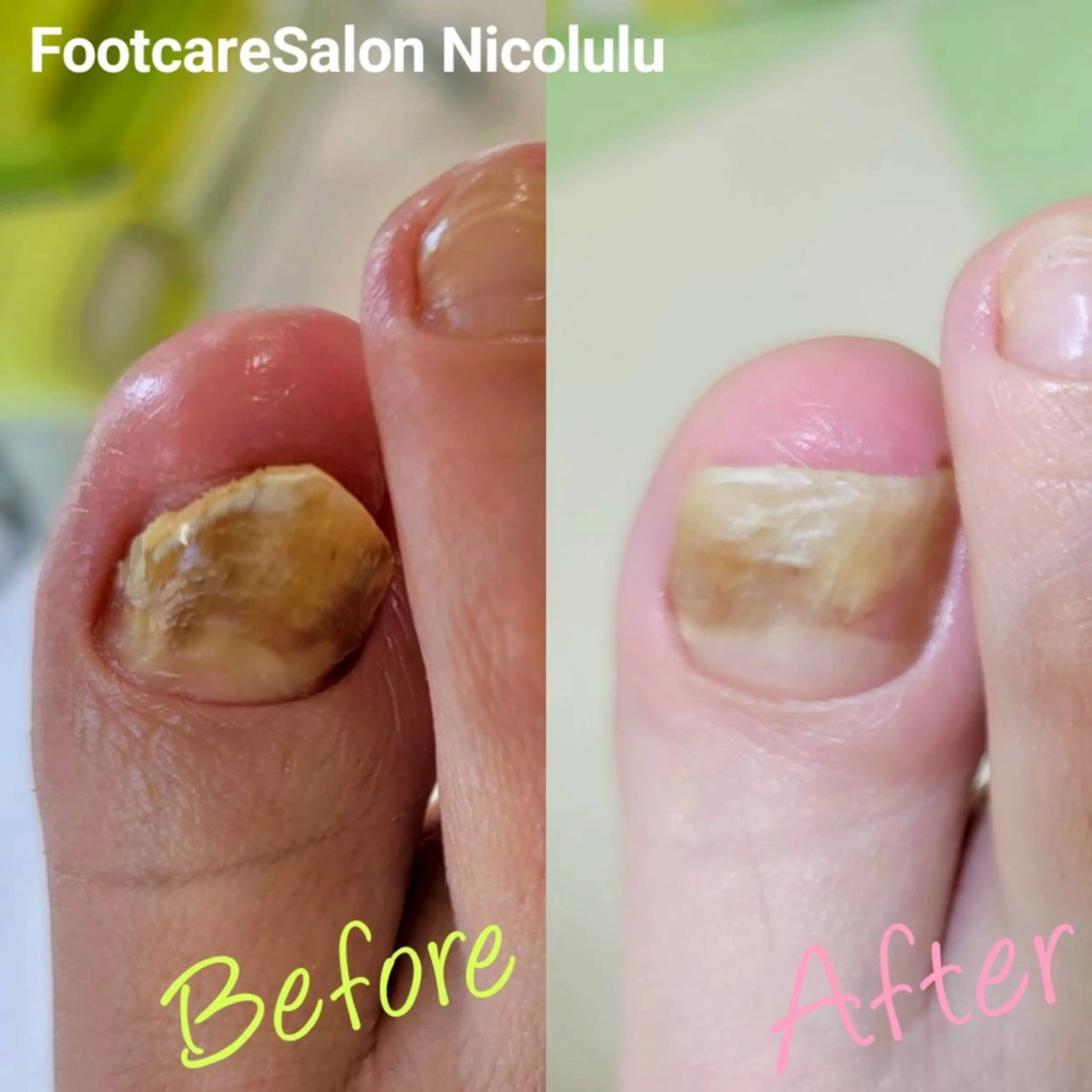 リラク 足トラブル専門 ニコルル金沢のエステ・リラクイメージ