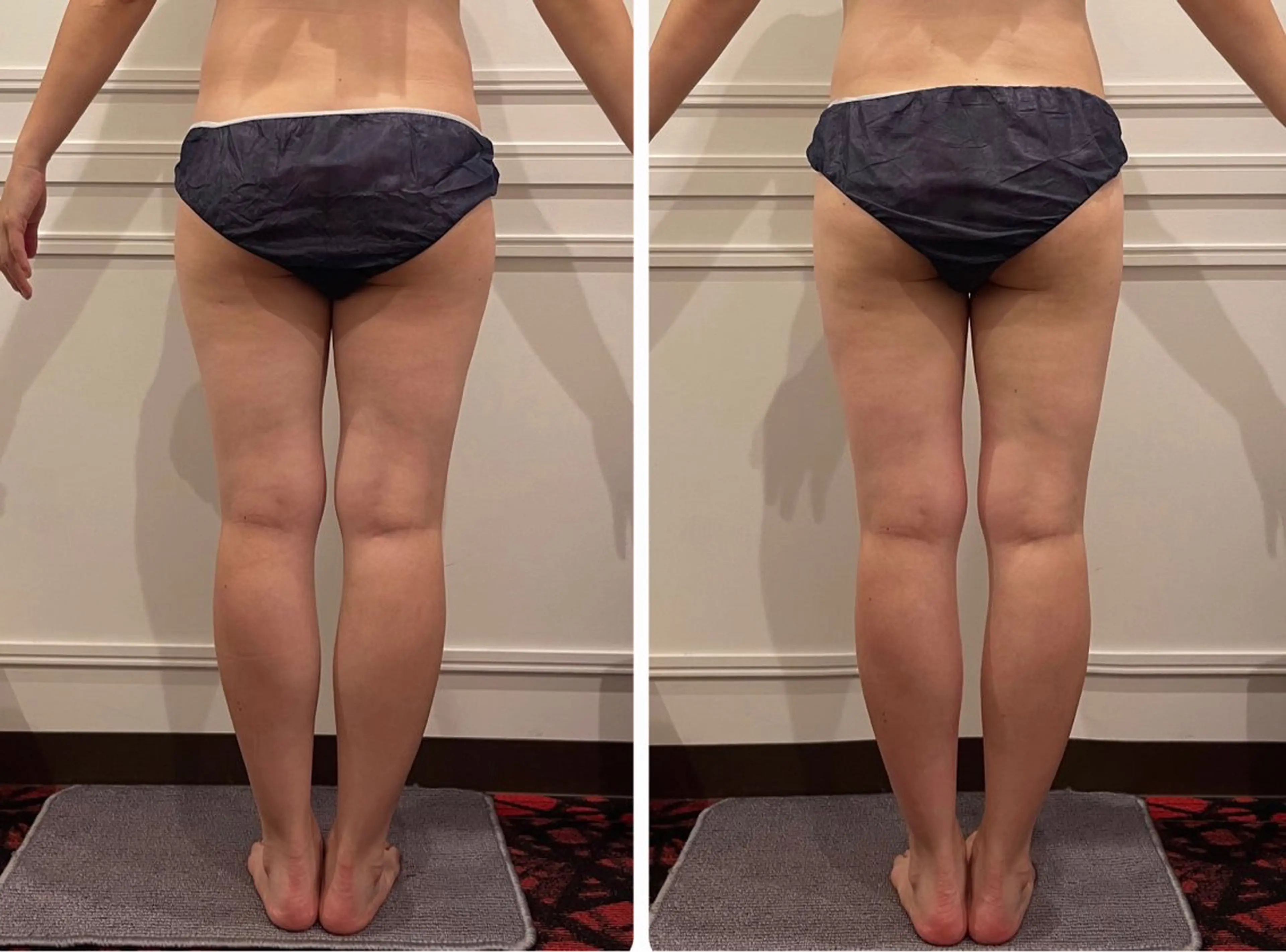 立体小顔×艶肌×美ボ ディ似合わせ施術 岡のエステ・リラクイメージ