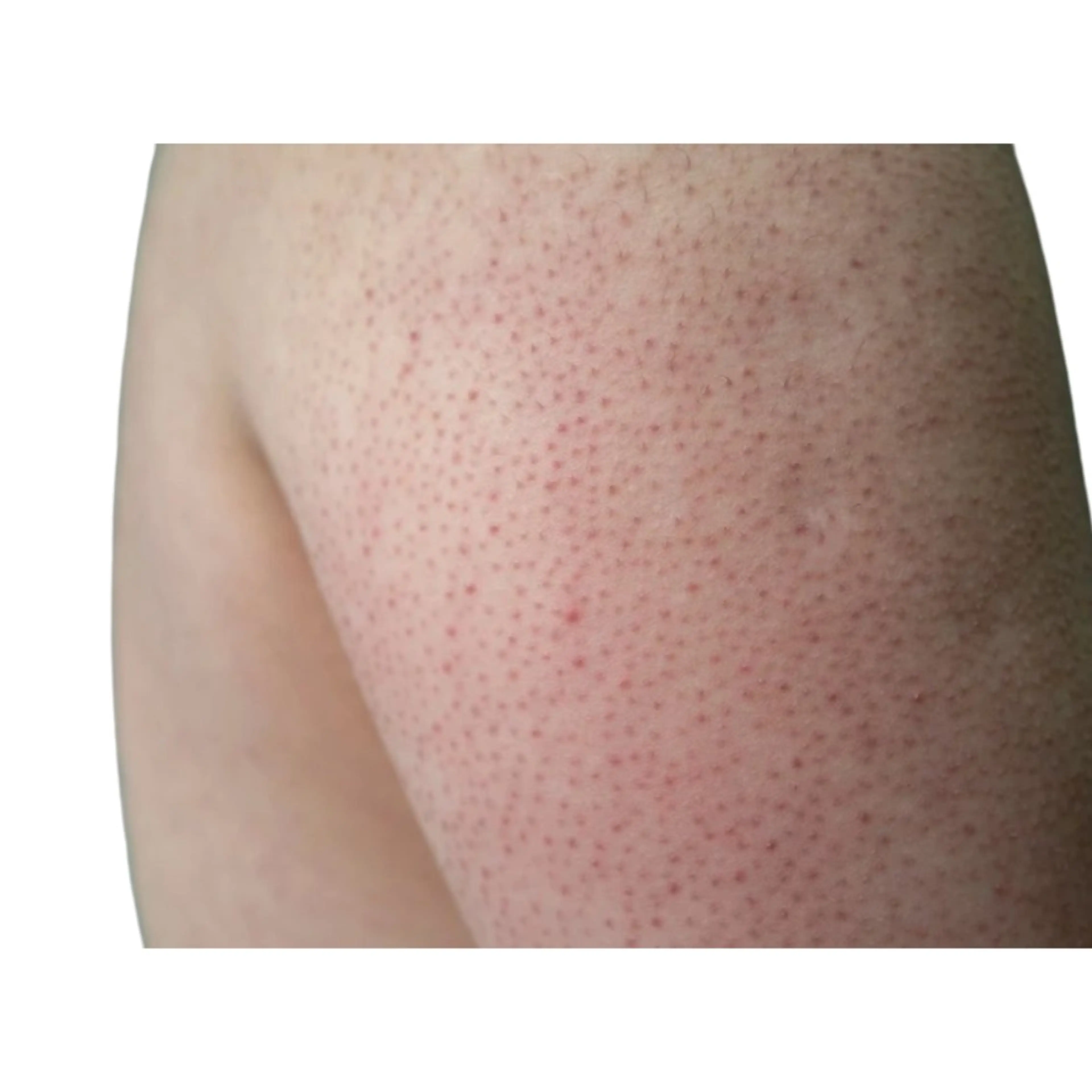 エステ サロンド エルのエステ・リラクイメージ