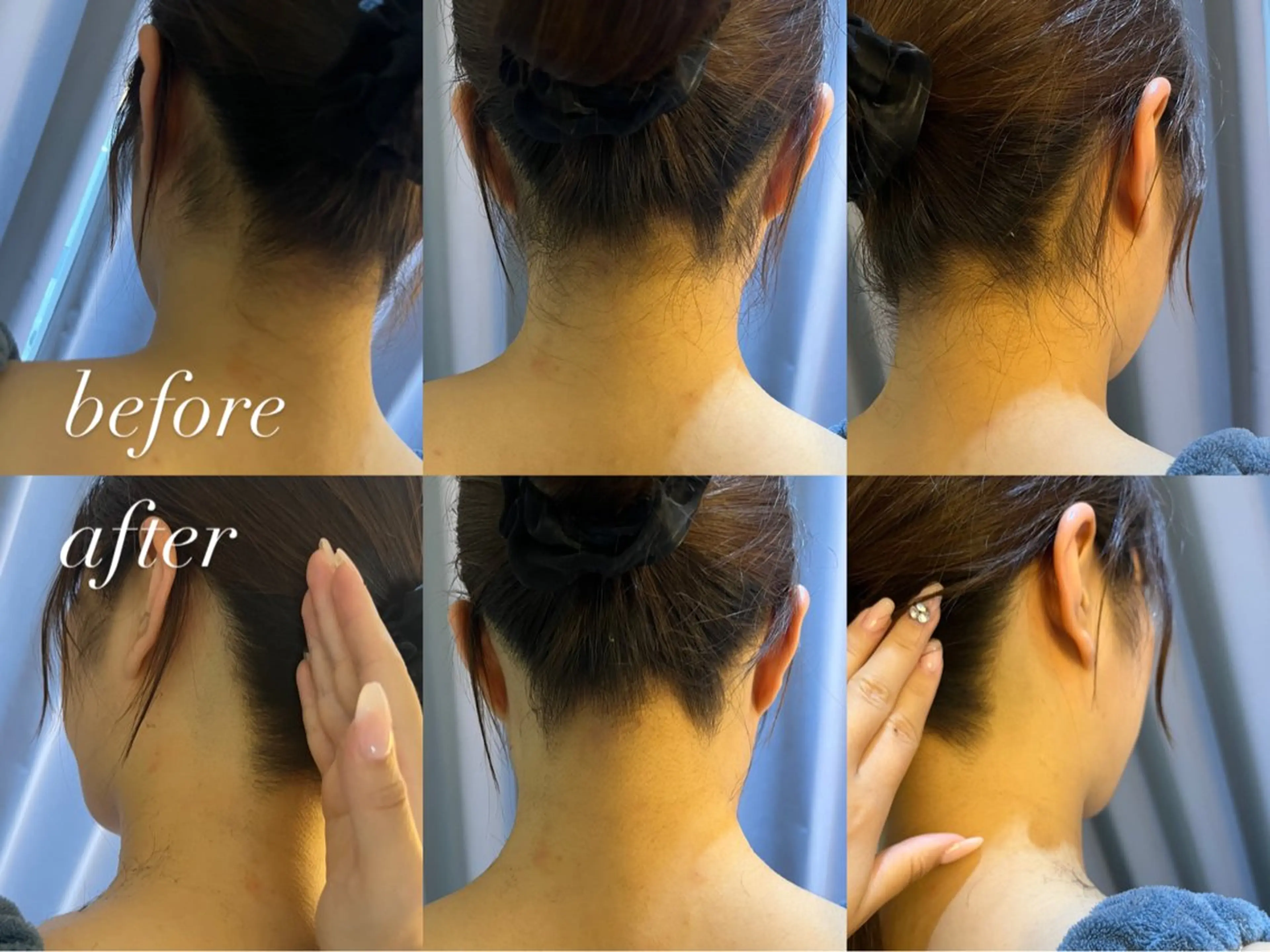 脱毛 うなじ脱毛/美肌脱毛 LABELのエステ・リラクイメージ