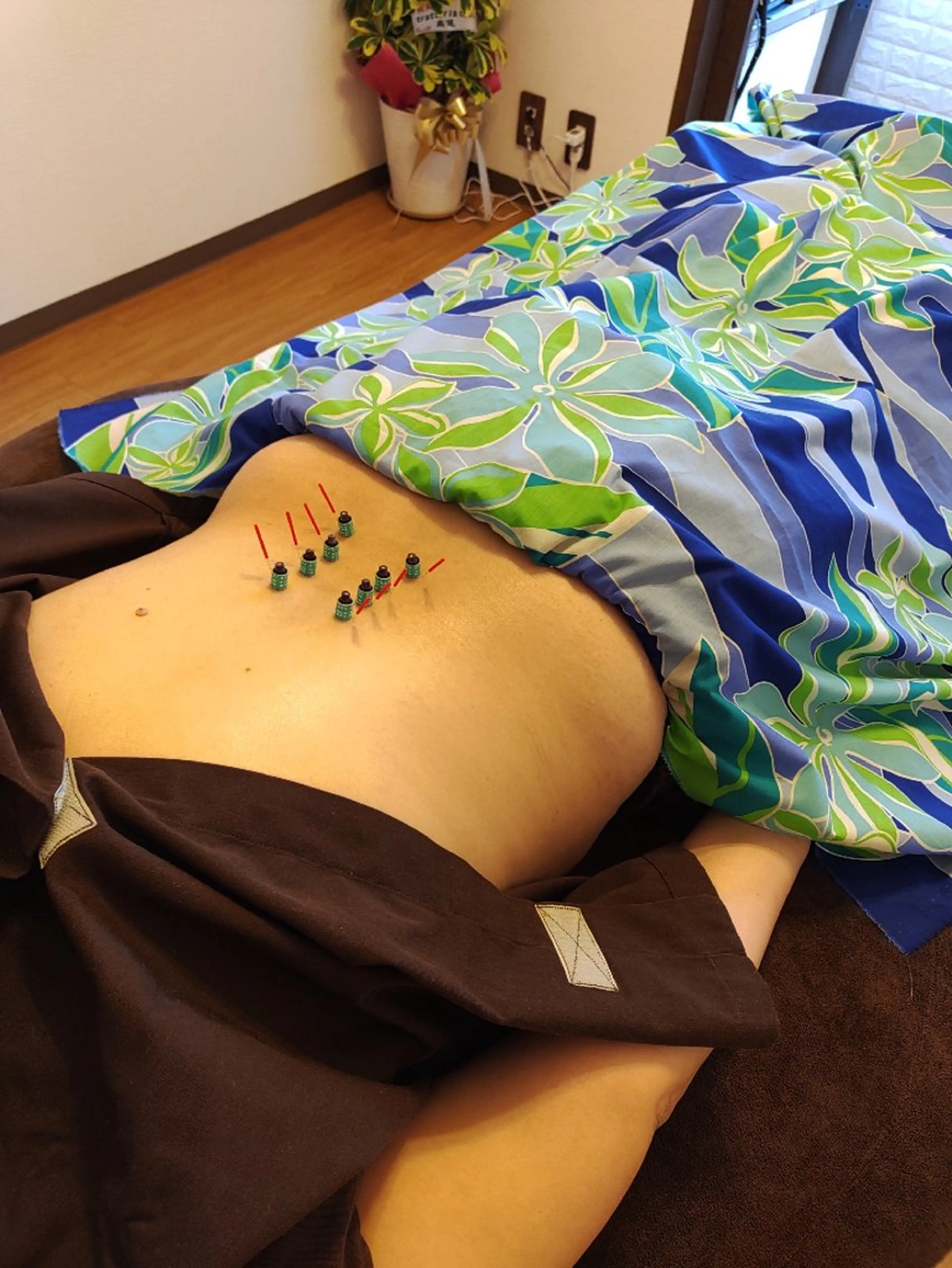 【鍼灸施術】しぶとい肩凝り、腰痛、眼精疲労等のお悩みを解消😊の写真