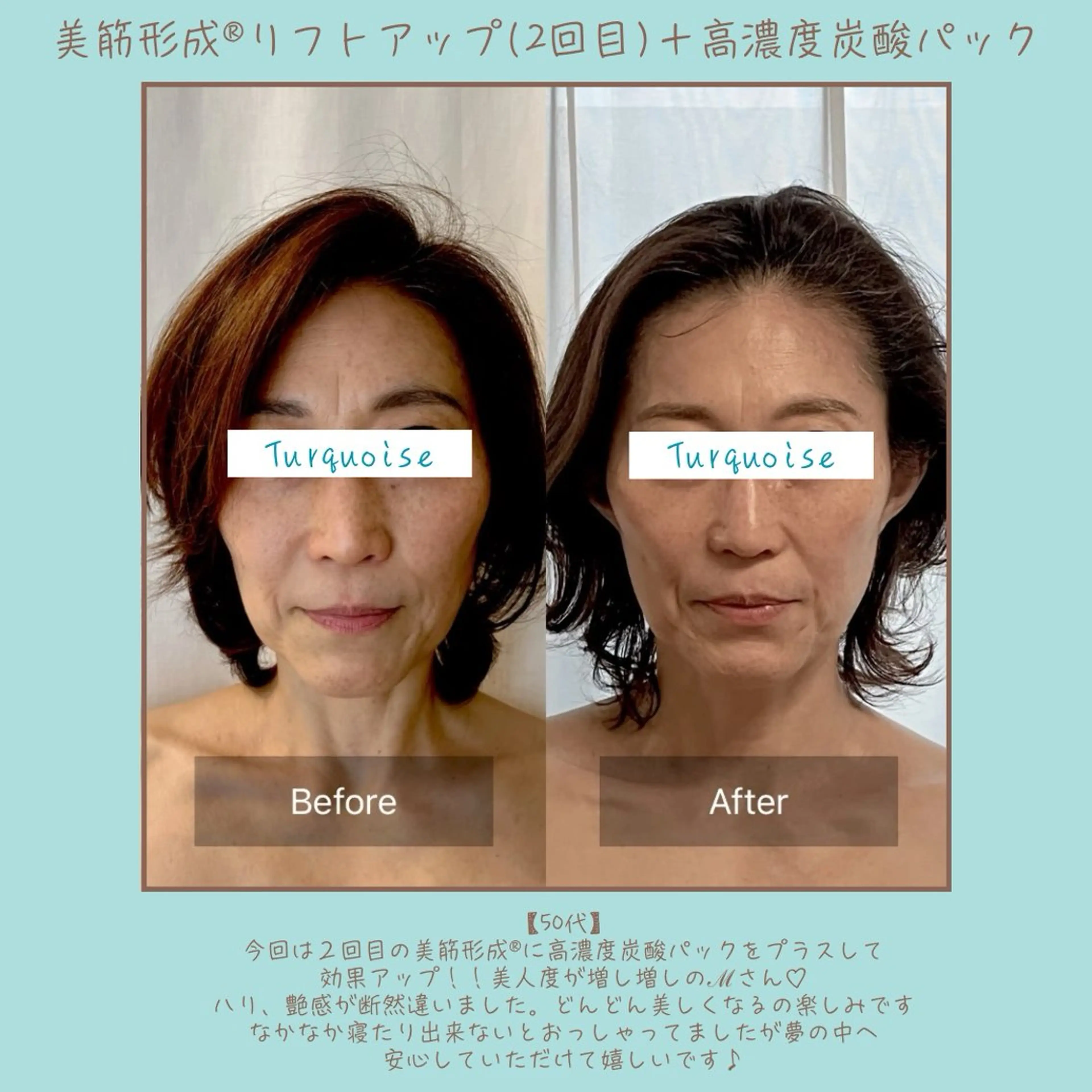 フェイシャルエステ Turquoiseのエステ・リラクイメージ