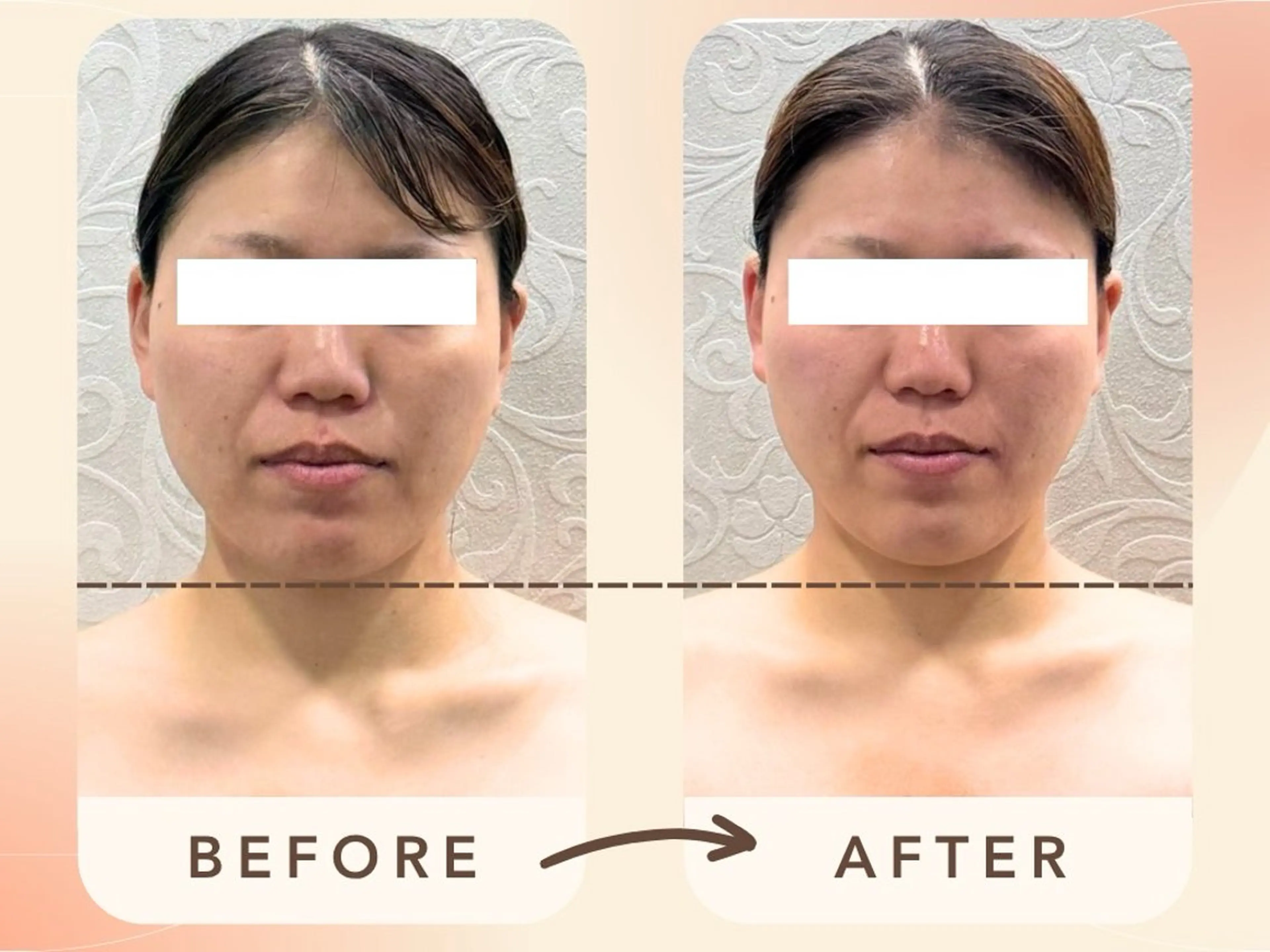 エステ リラク MIRAI小顔 岡山店のエステ・リラクイメージ