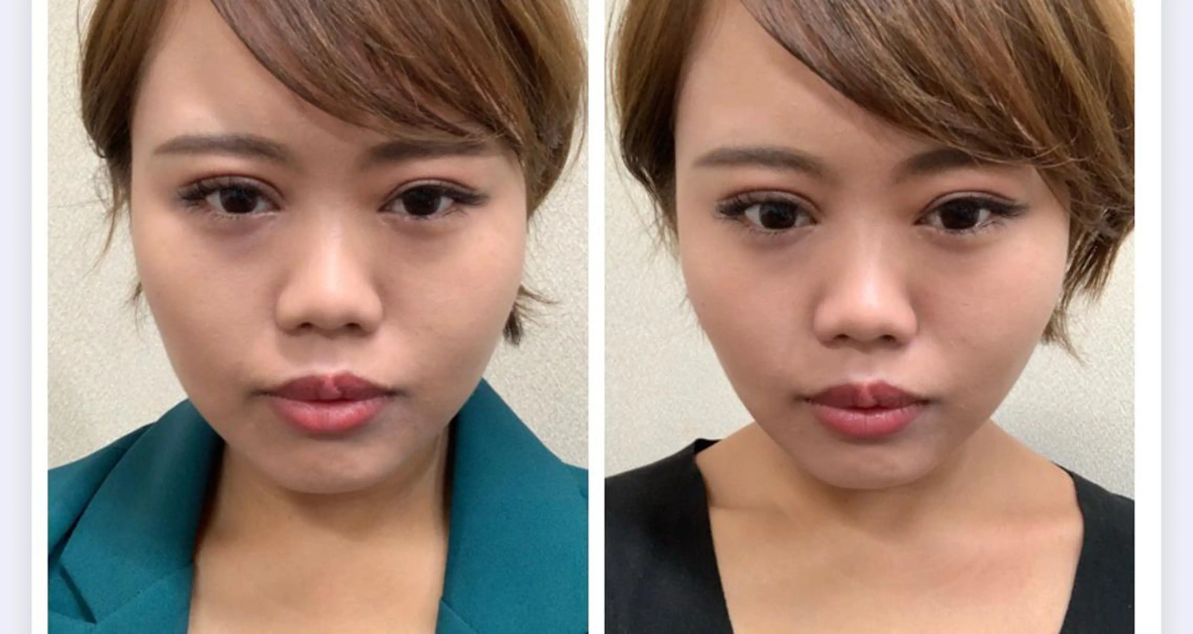 メンズ 大阪脱毛|ちぇるま| 眉毛Wax｜美肌管理のエステ・リラクイメージ