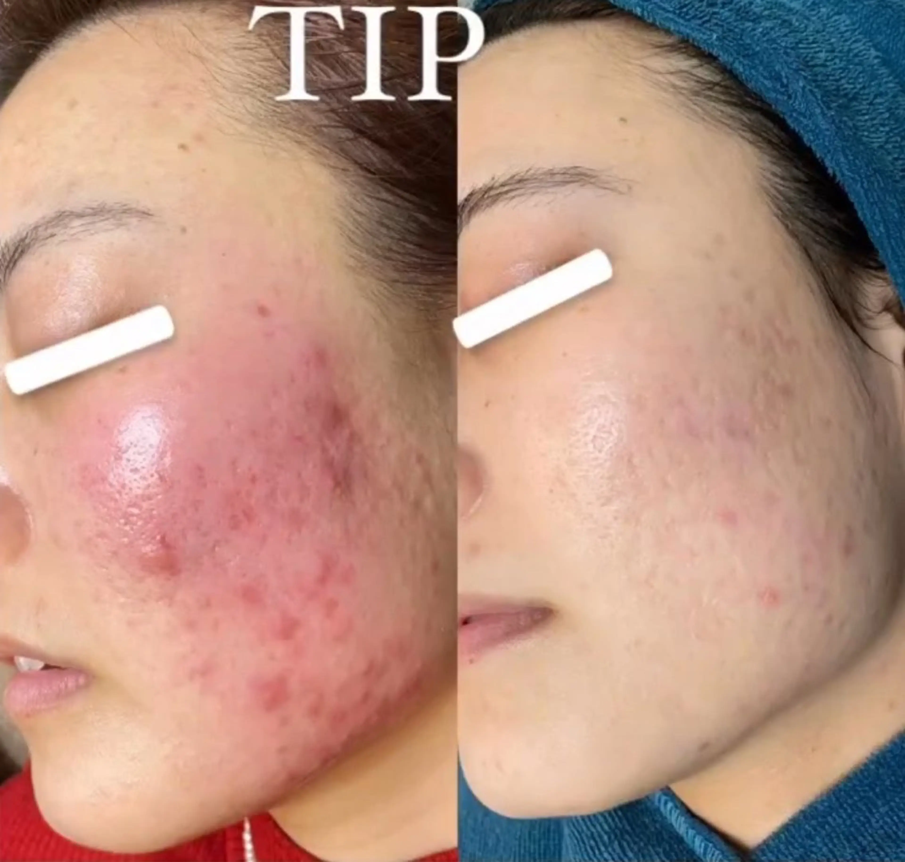 メンズ ソリッジ肌管理室所属・山村 有花のエステ・リラクイメージ