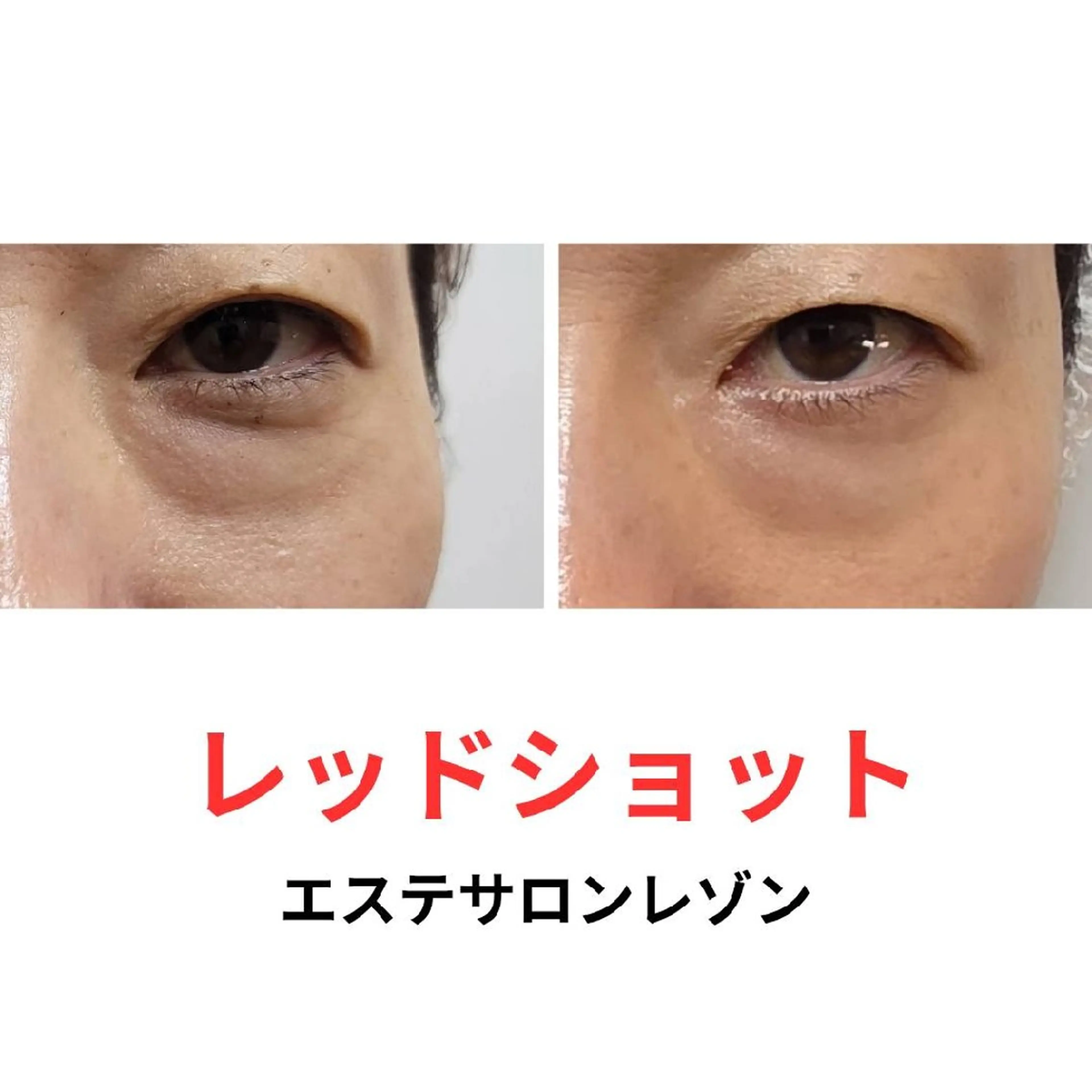 〈ニキビケアサロン〉 レゾン京橋店/ 浅川のエステ・リラクイメージ