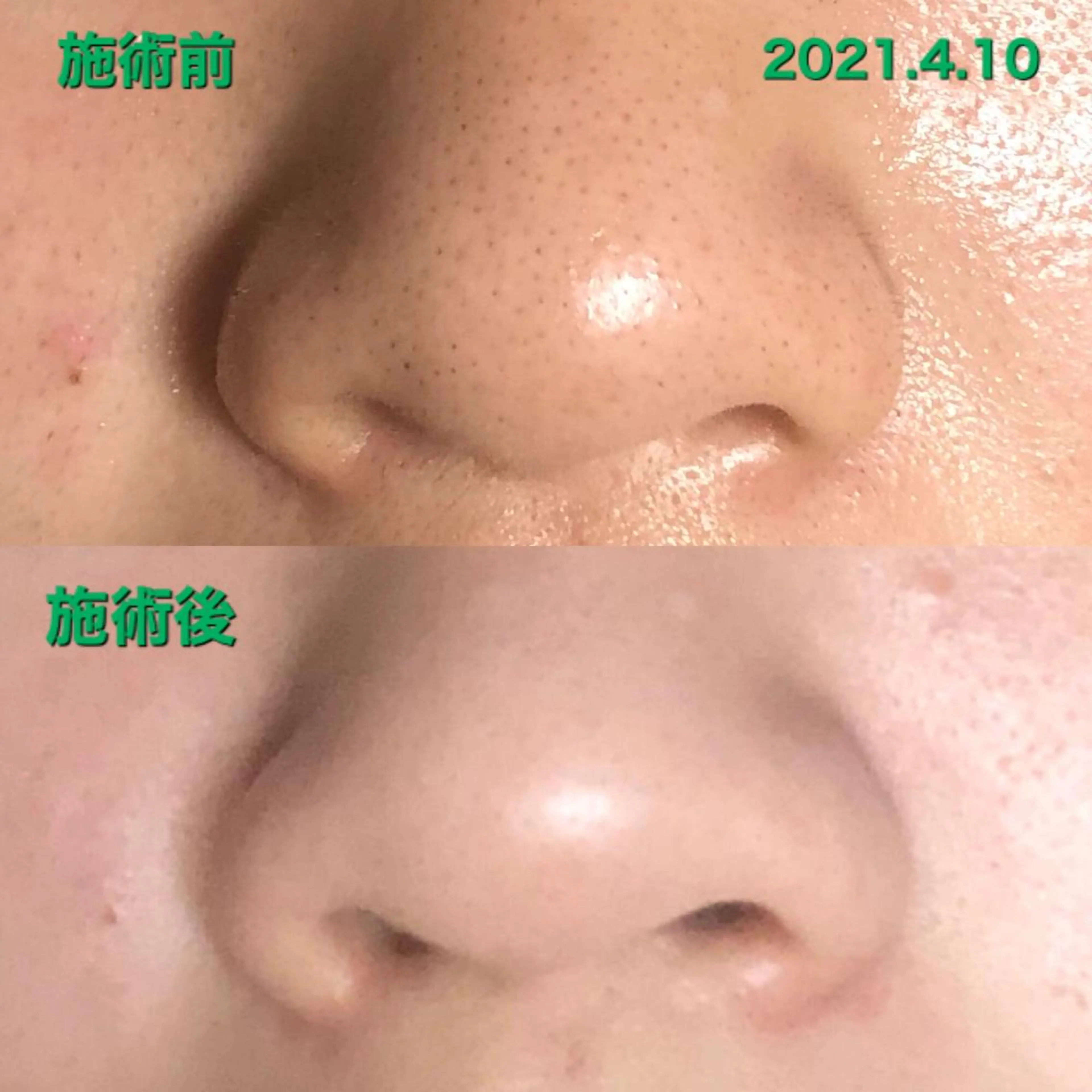 エステ La.pport ラポールのエステ・リラクイメージ