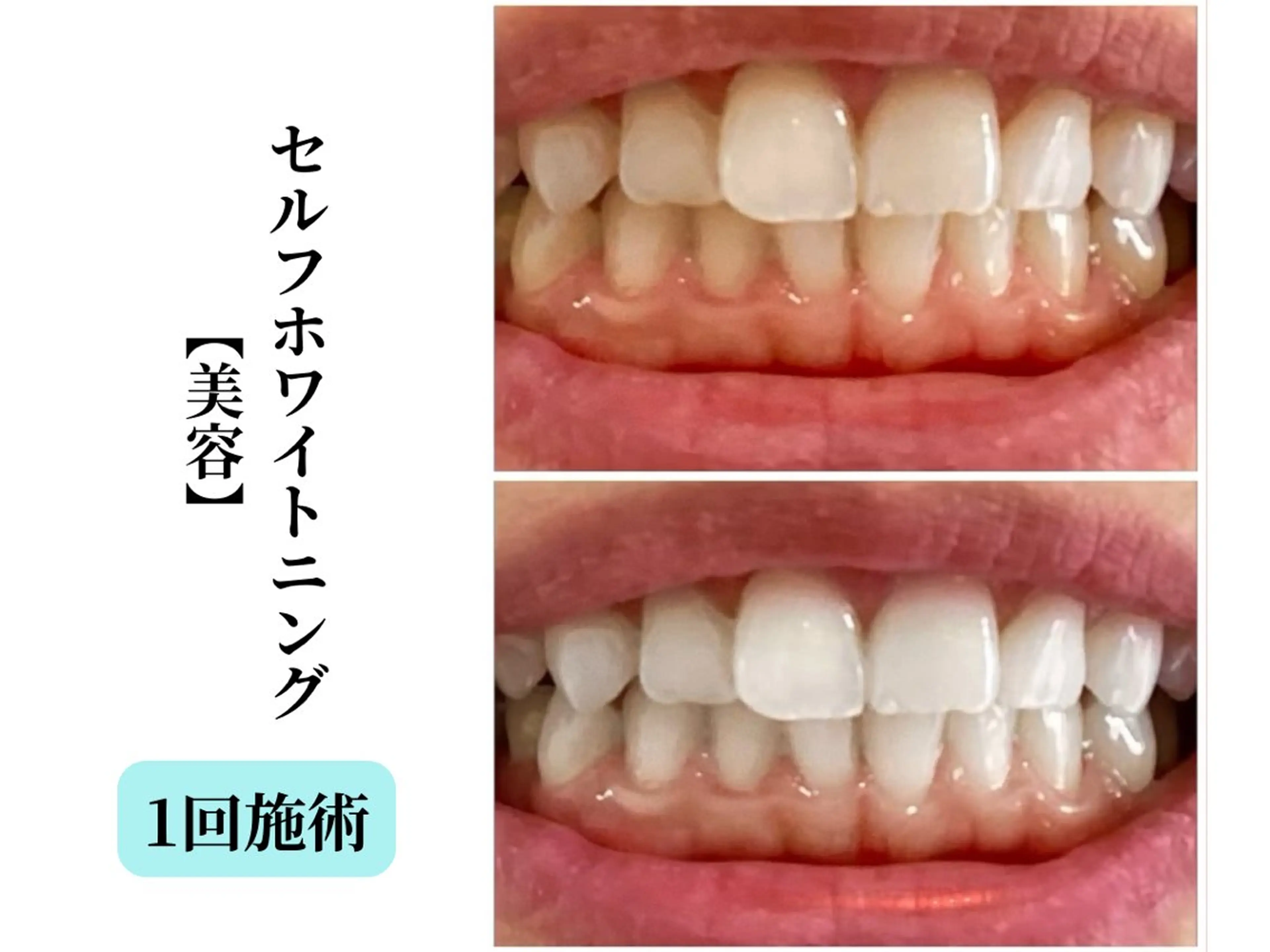 エステ Belle White所属・本格痩身＊透明美肌 BelleWhiteのエステ・リラクイメージ