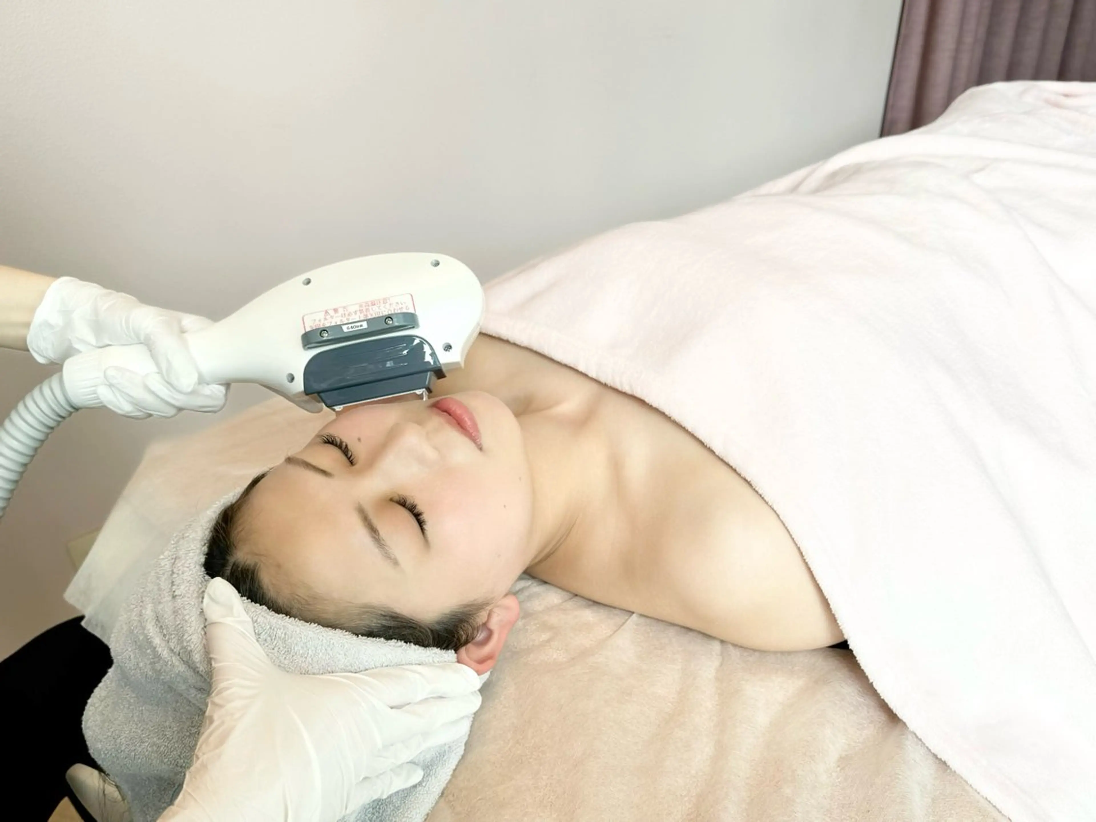 ✨🌼【初回限定価格】顔脱毛🌼✨の写真