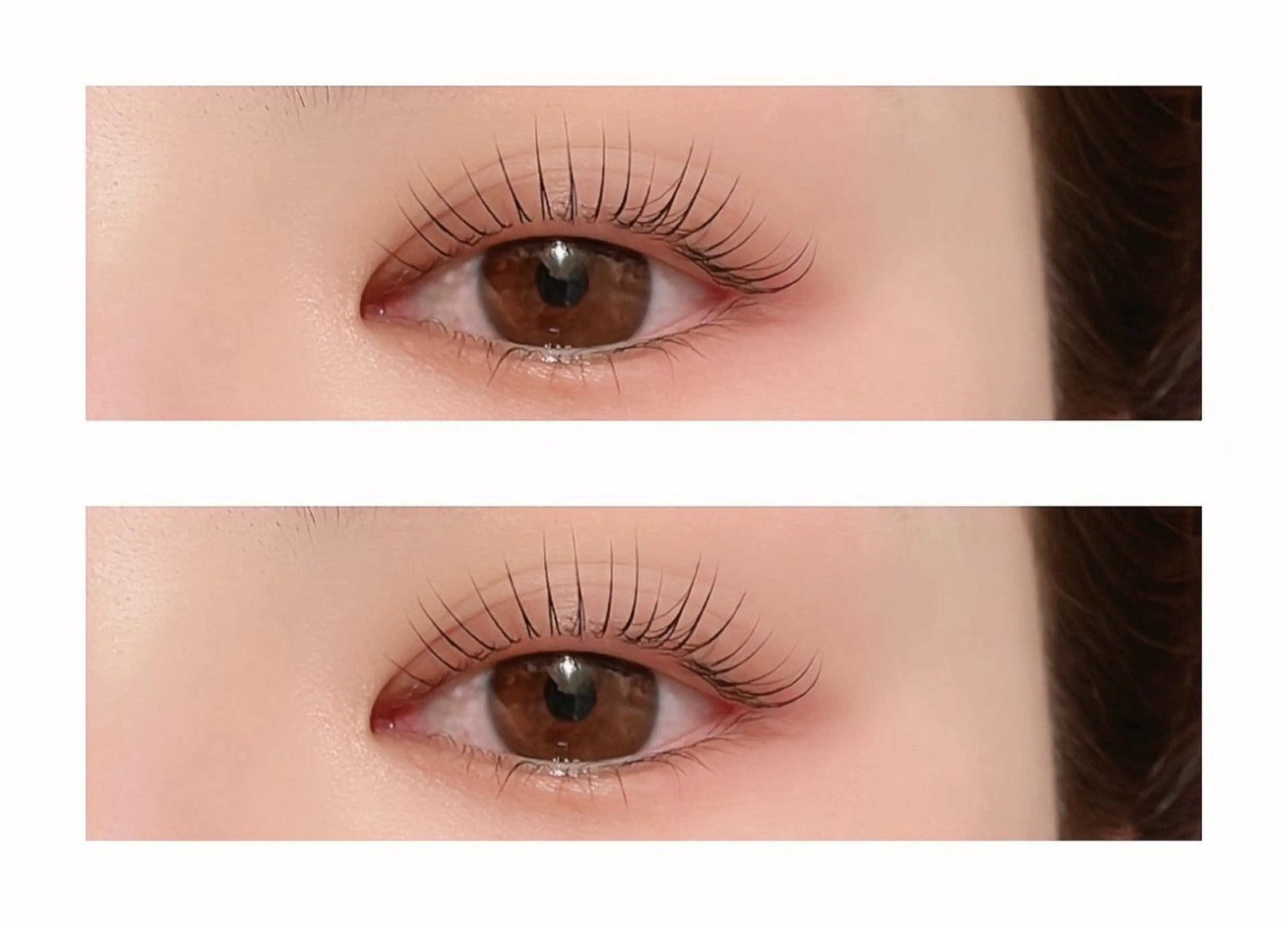 マツエク・マツパ 【医療提携】脱毛 小顔ハーブピーリングのエステ・リラクイメージ