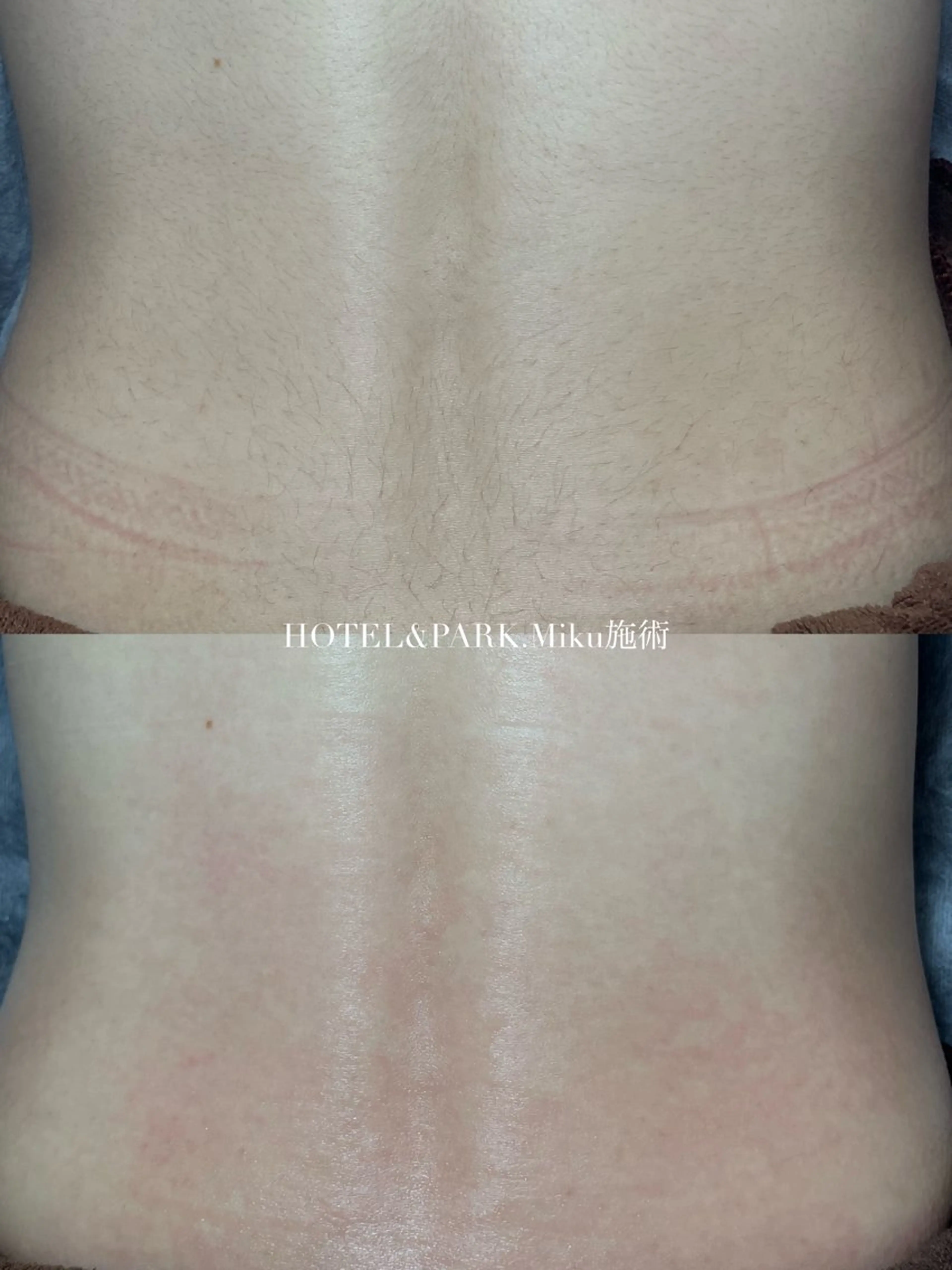 HOTEL&PARK Mikuワックス脱毛のエステ・リラクイメージ
