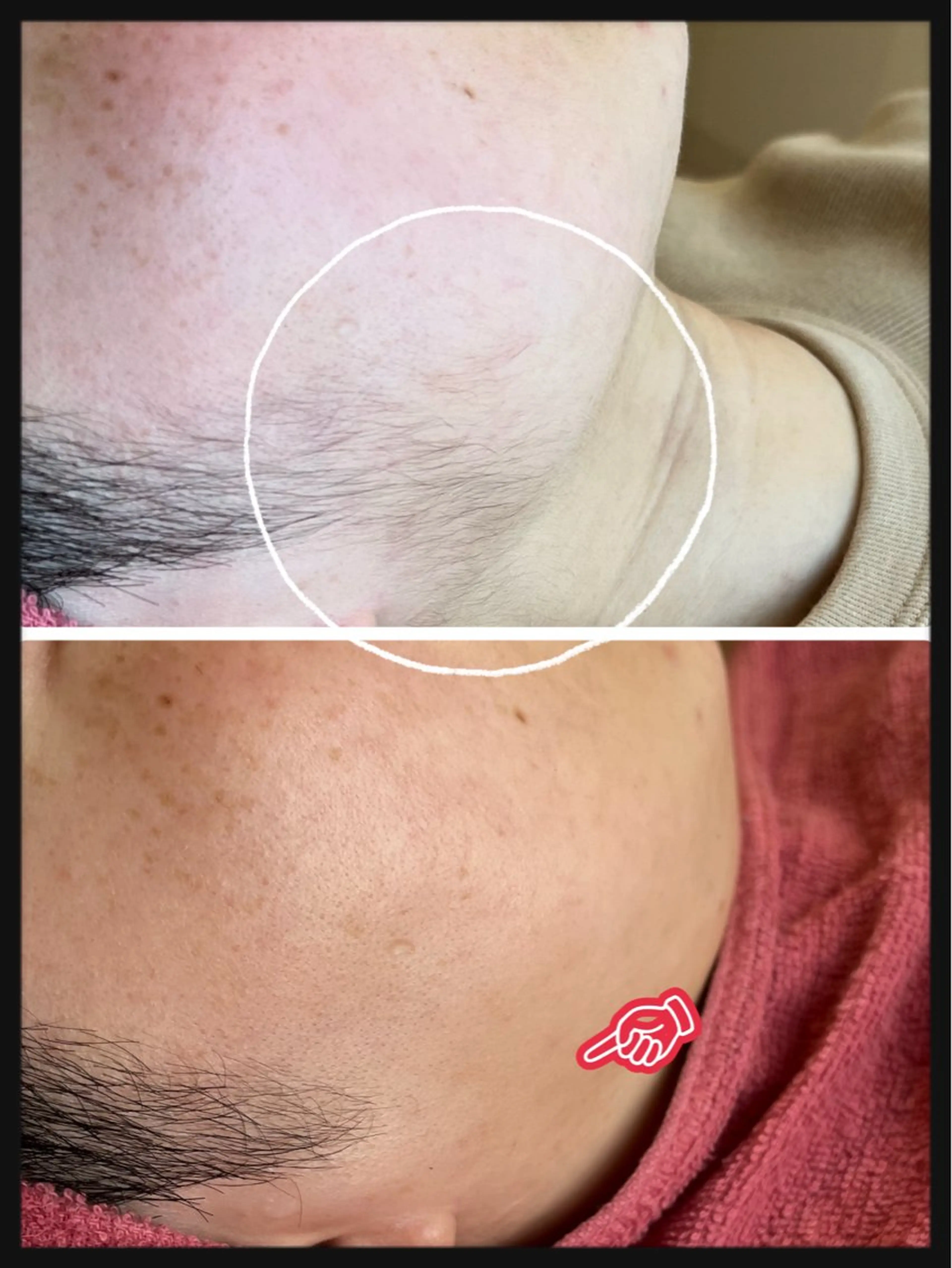 脱毛 Dione八王子店所属・LUKE （ルーク）のエステ・リラクイメージ