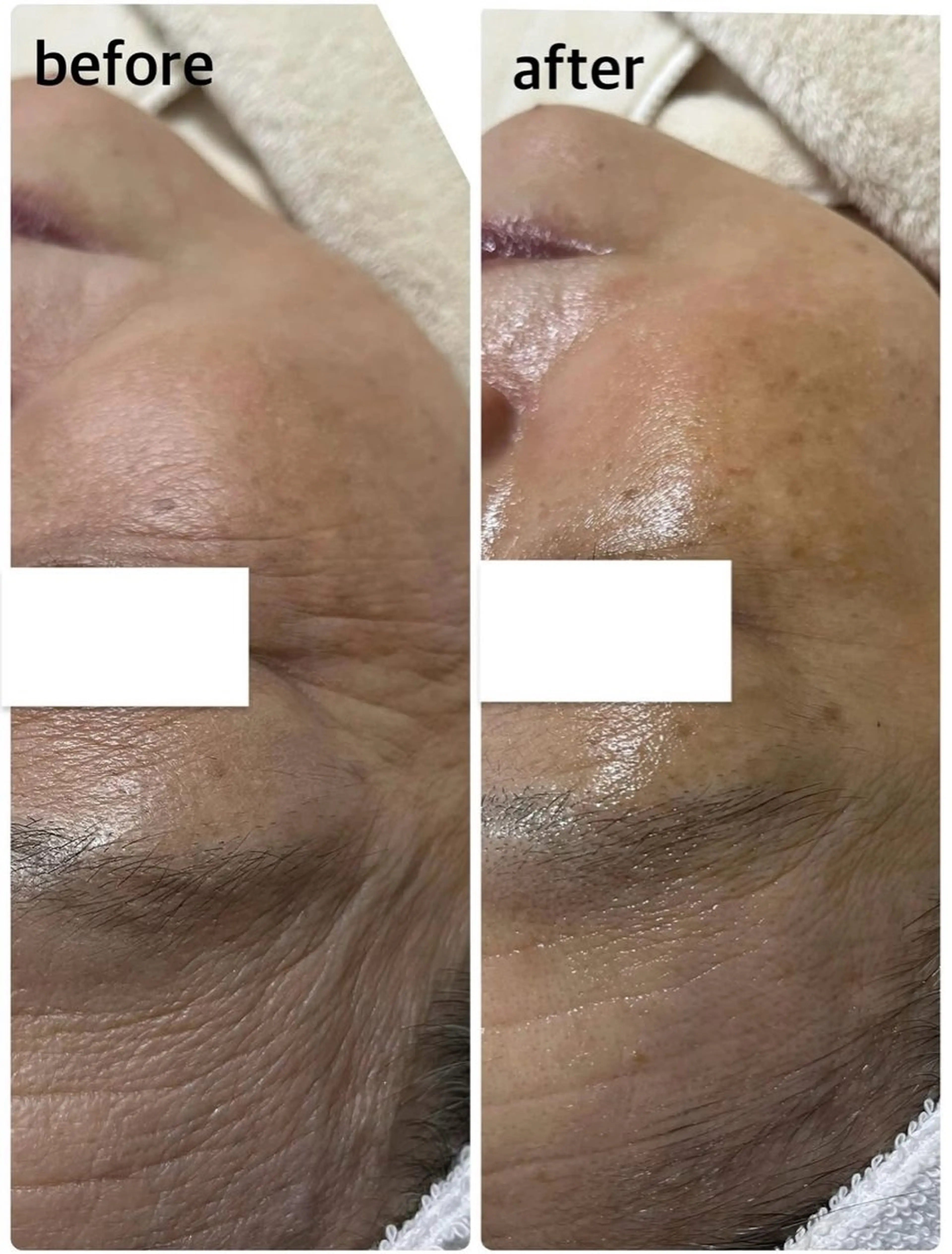 ハリ、美白がほしい方〉〉〉３Ｄスフィアの写真