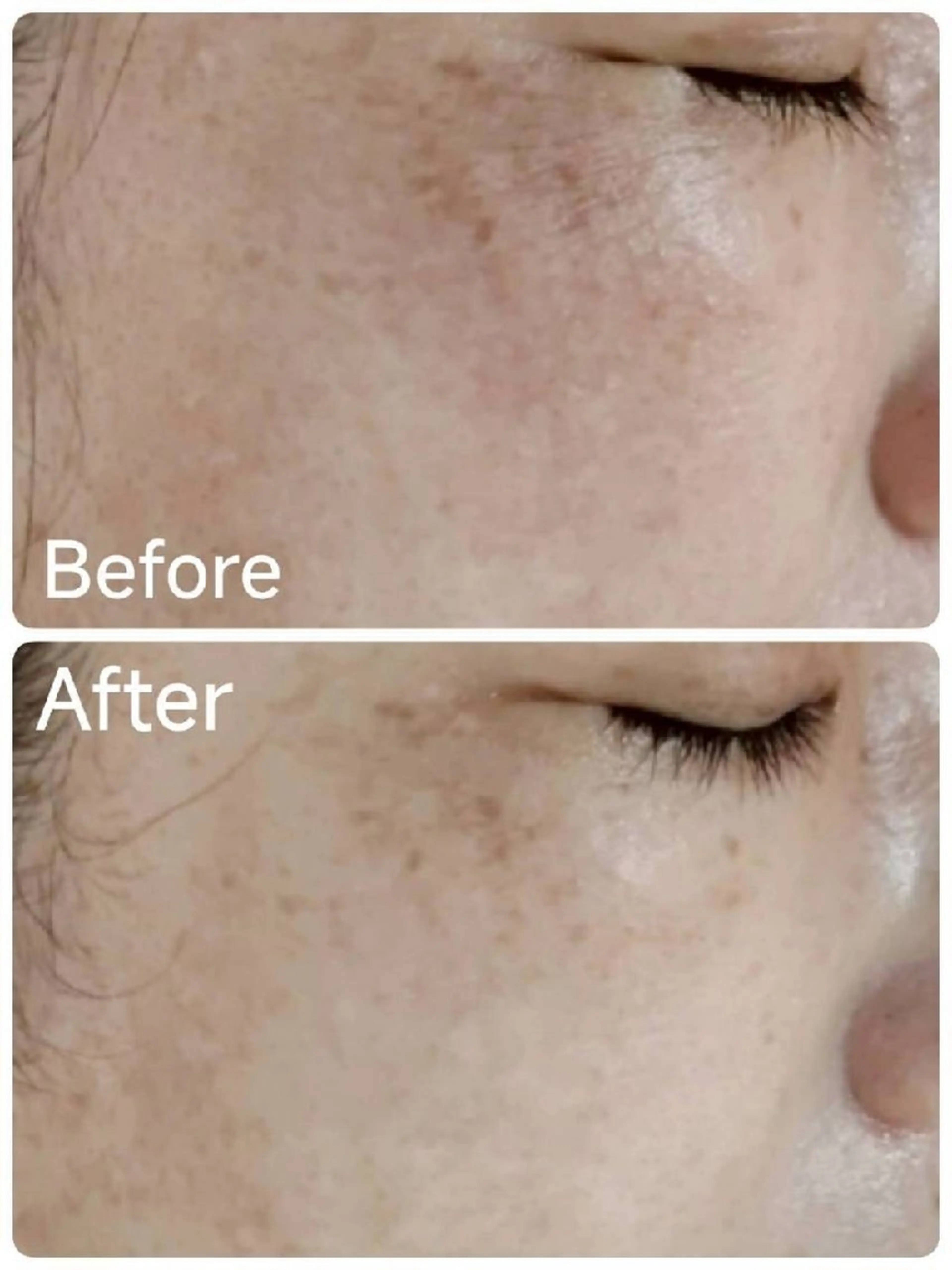 エステ ICHOOSE/ 代々木上原のエステ・リラクイメージ