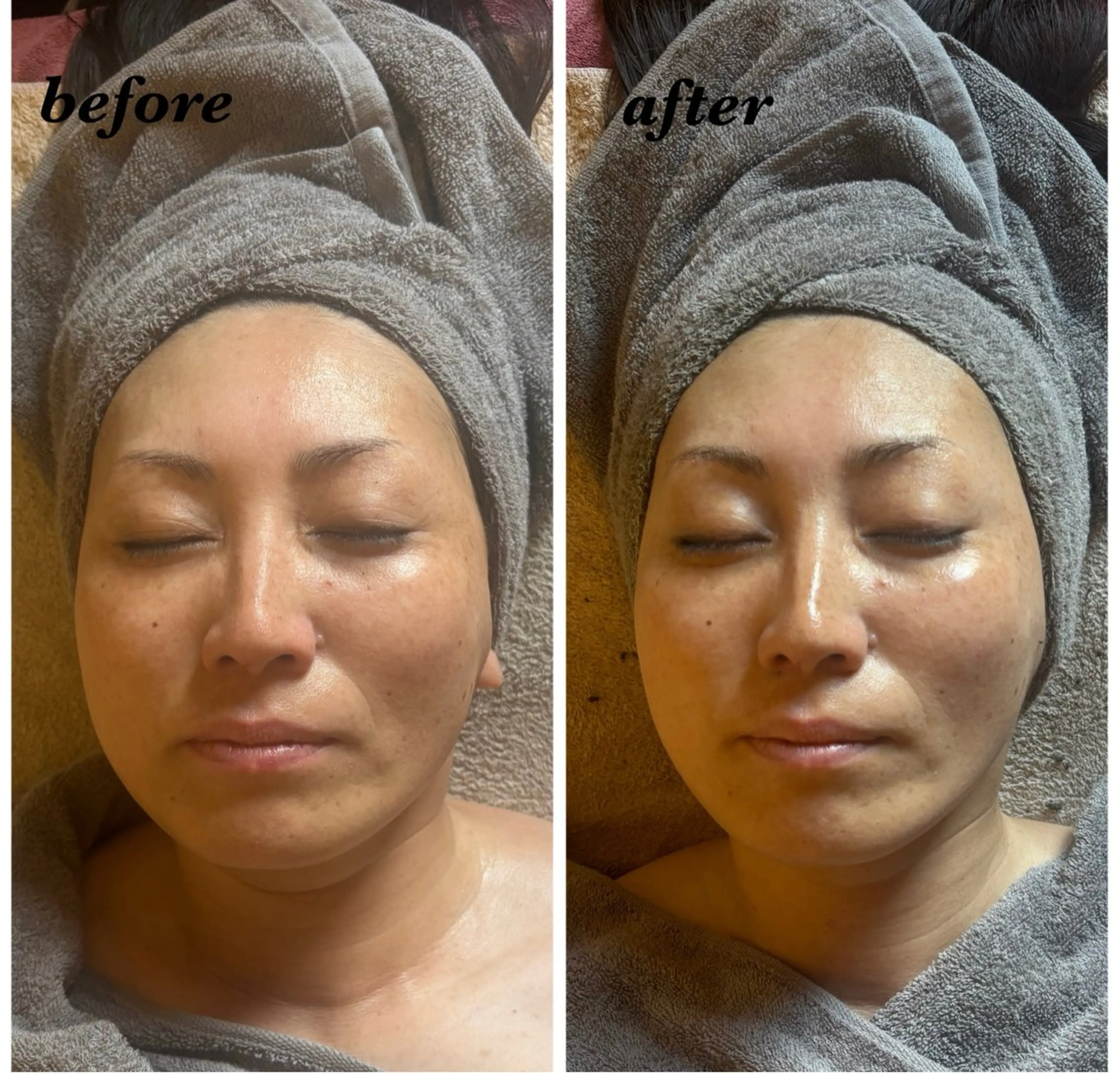 ハーブピーリング専門 毛穴洗浄❤️眉waxのエステ・リラクイメージ