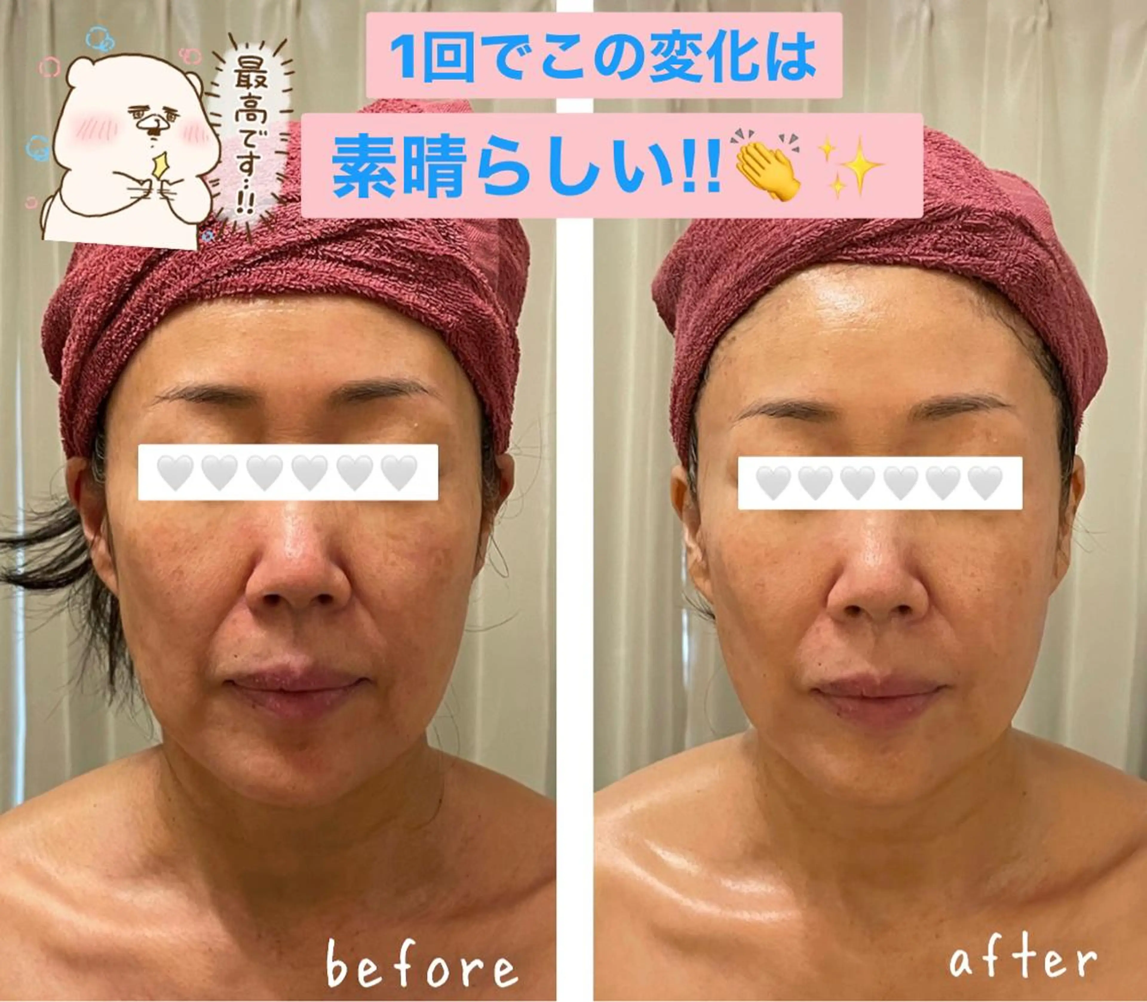 35歳からの エイジングケアサロンのエステ・リラクイメージ