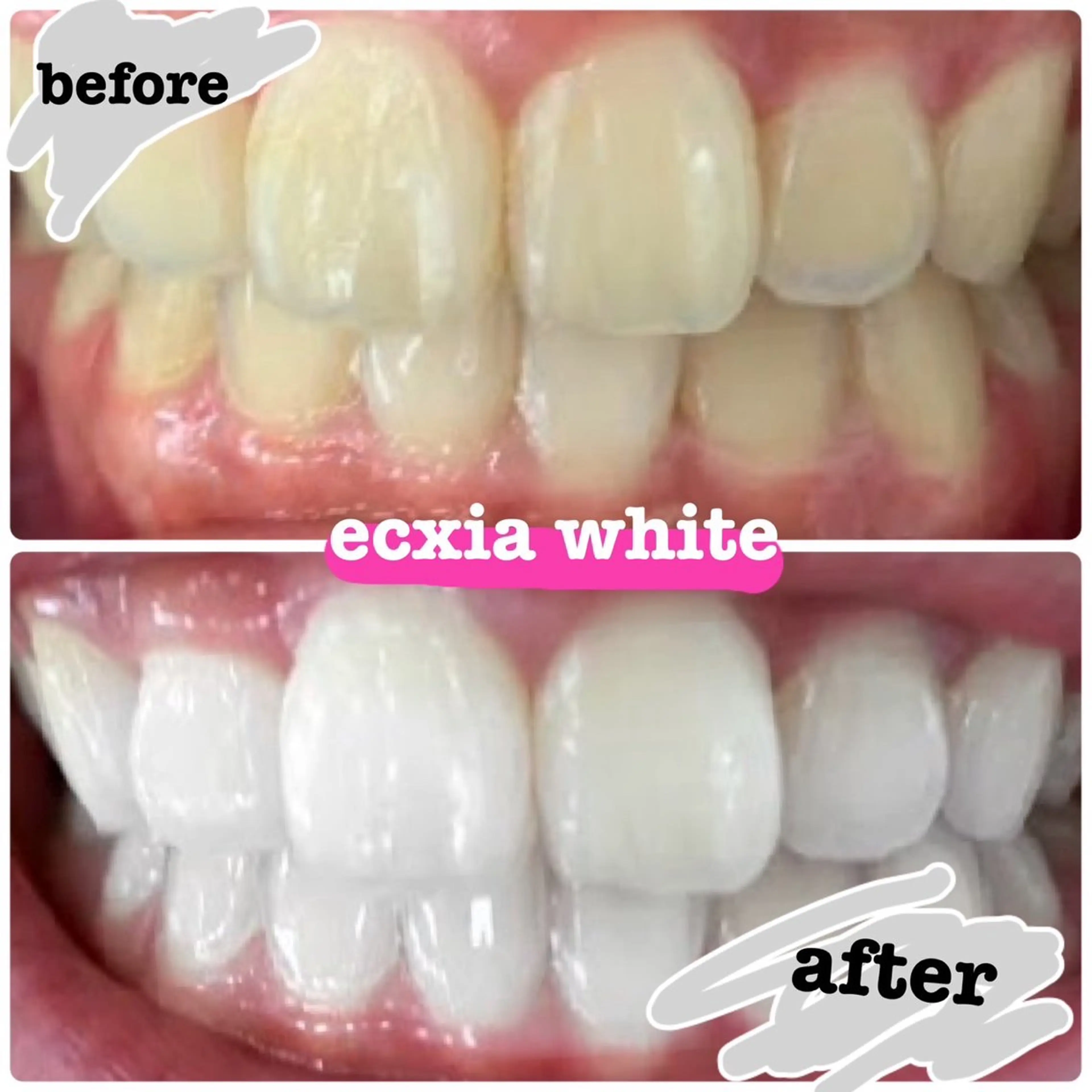 【人気No.1メニュー】スペシャルメニュー真っ白お約束★￥14500→￥11000★の写真