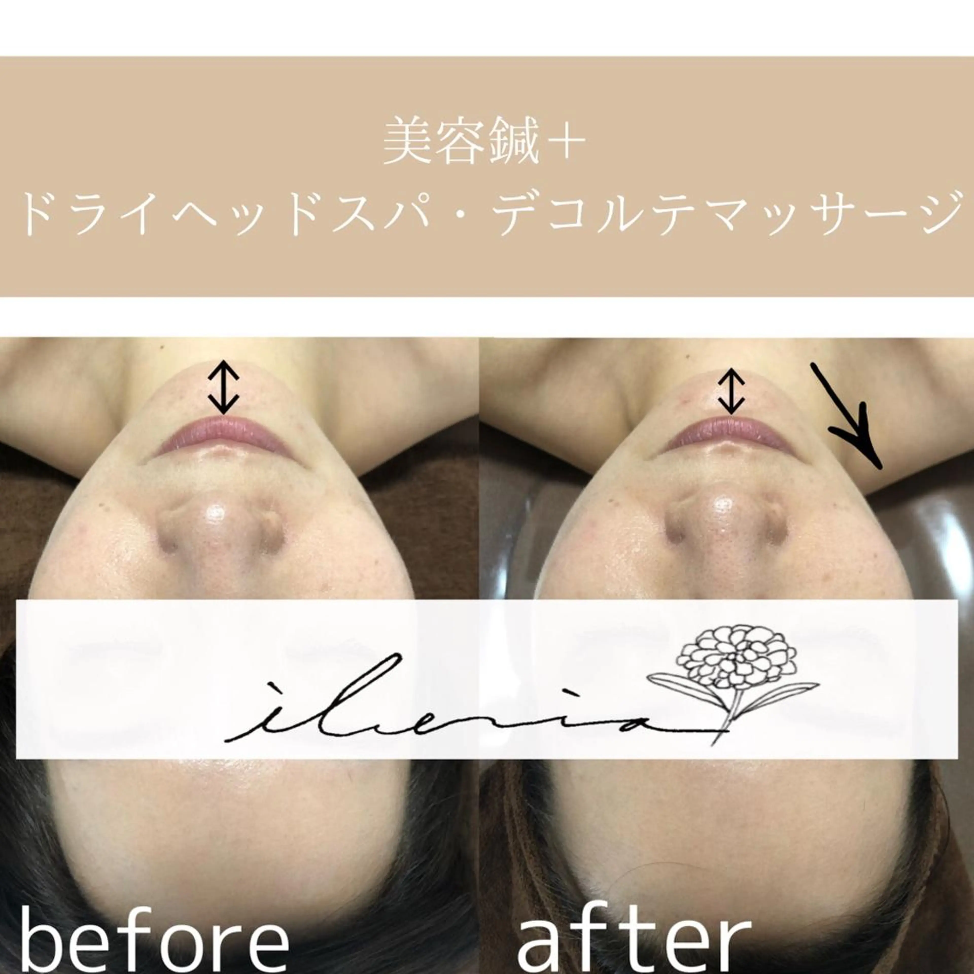 心斎橋痩身ダイエット 韓国.美容鍼.小顔のエステ・リラクイメージ