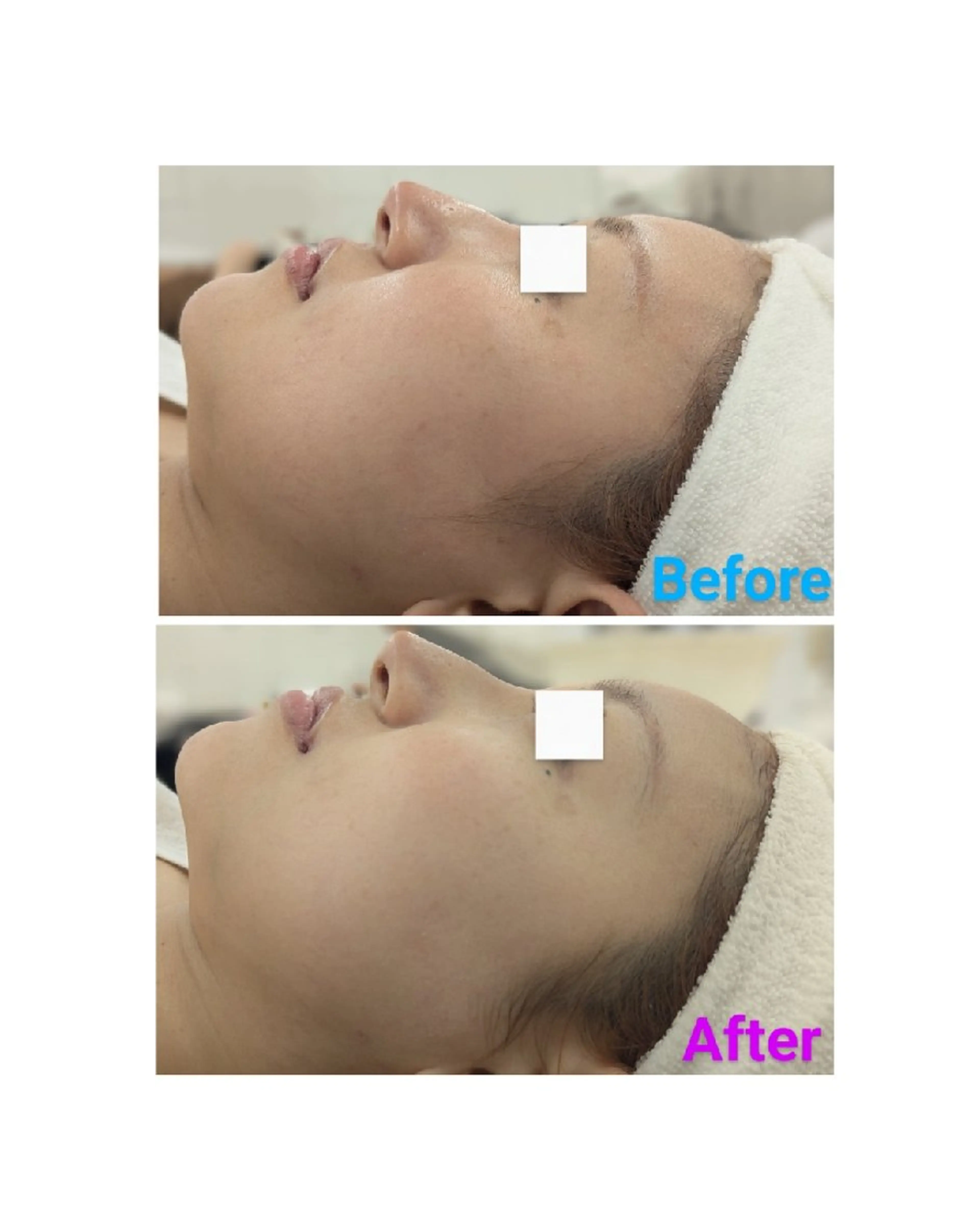 【シワ・たるみ】潤いハリ感UPの写真