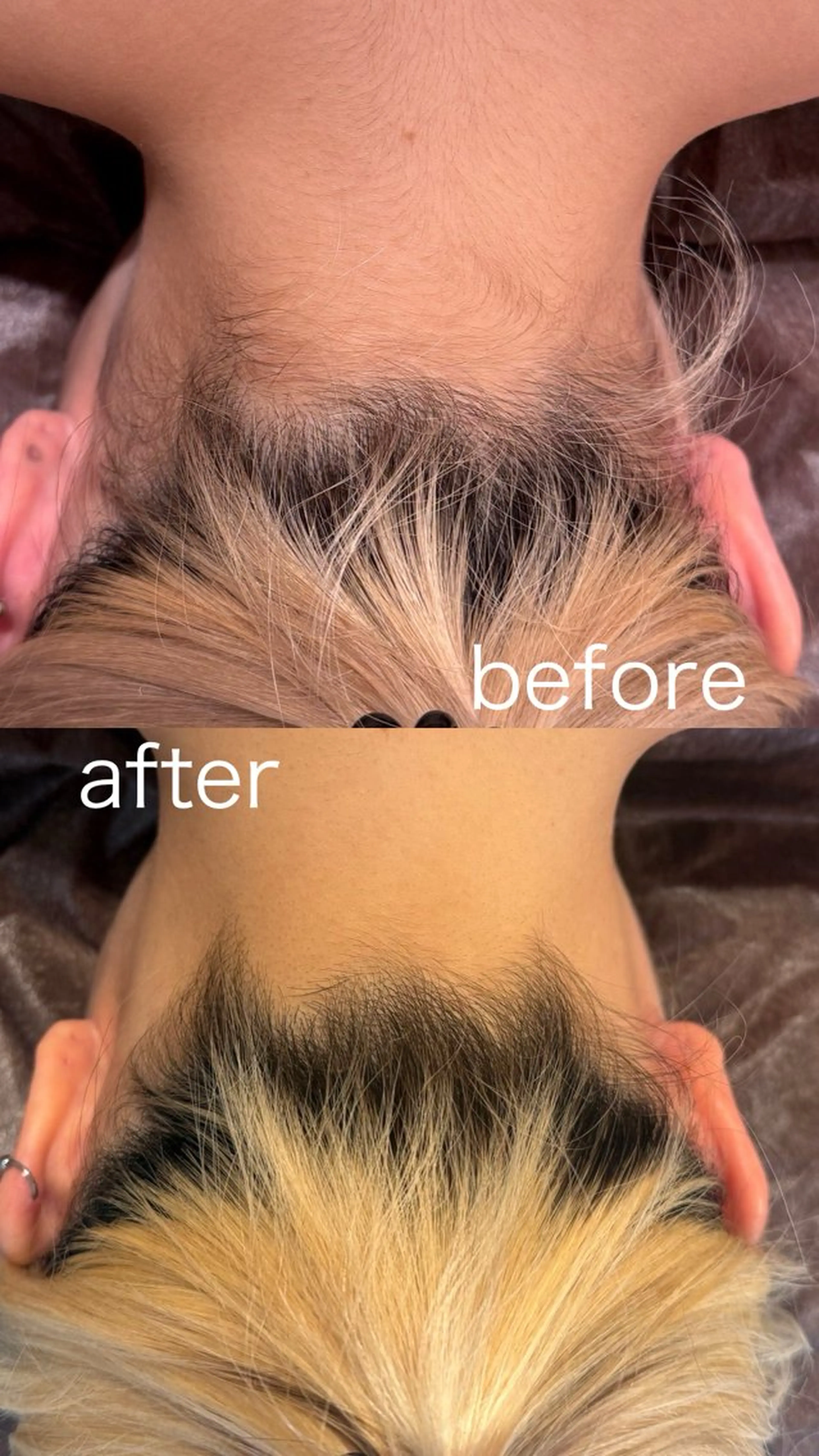 全身脱毛(顔、VIO込み) | 一般価格¥16,500の写真