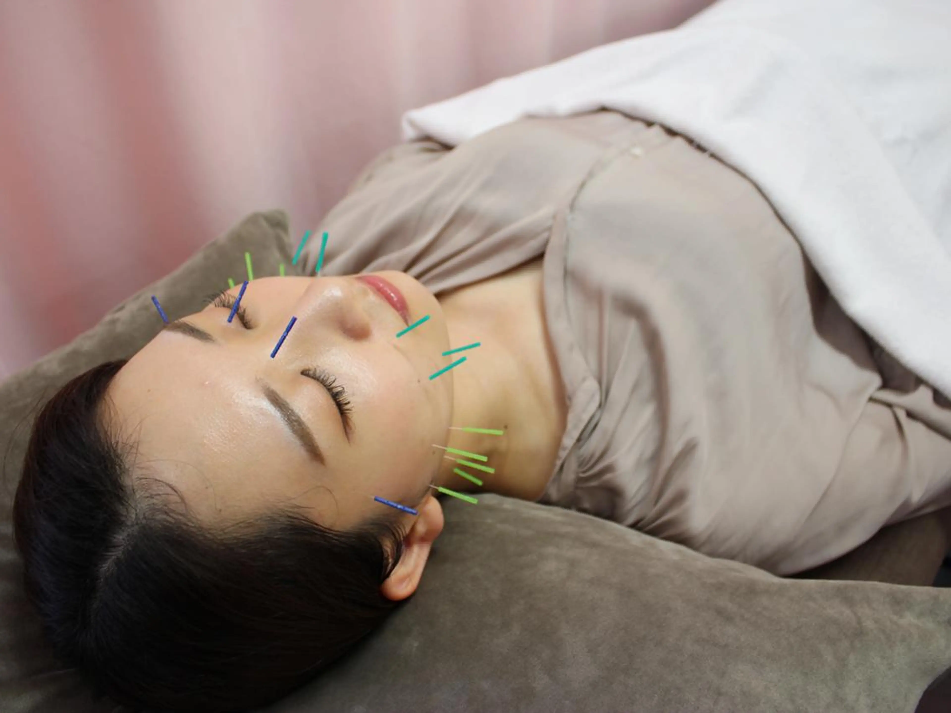 同心整骨院 美容鍼・整体・小顔のエステ・リラクイメージ