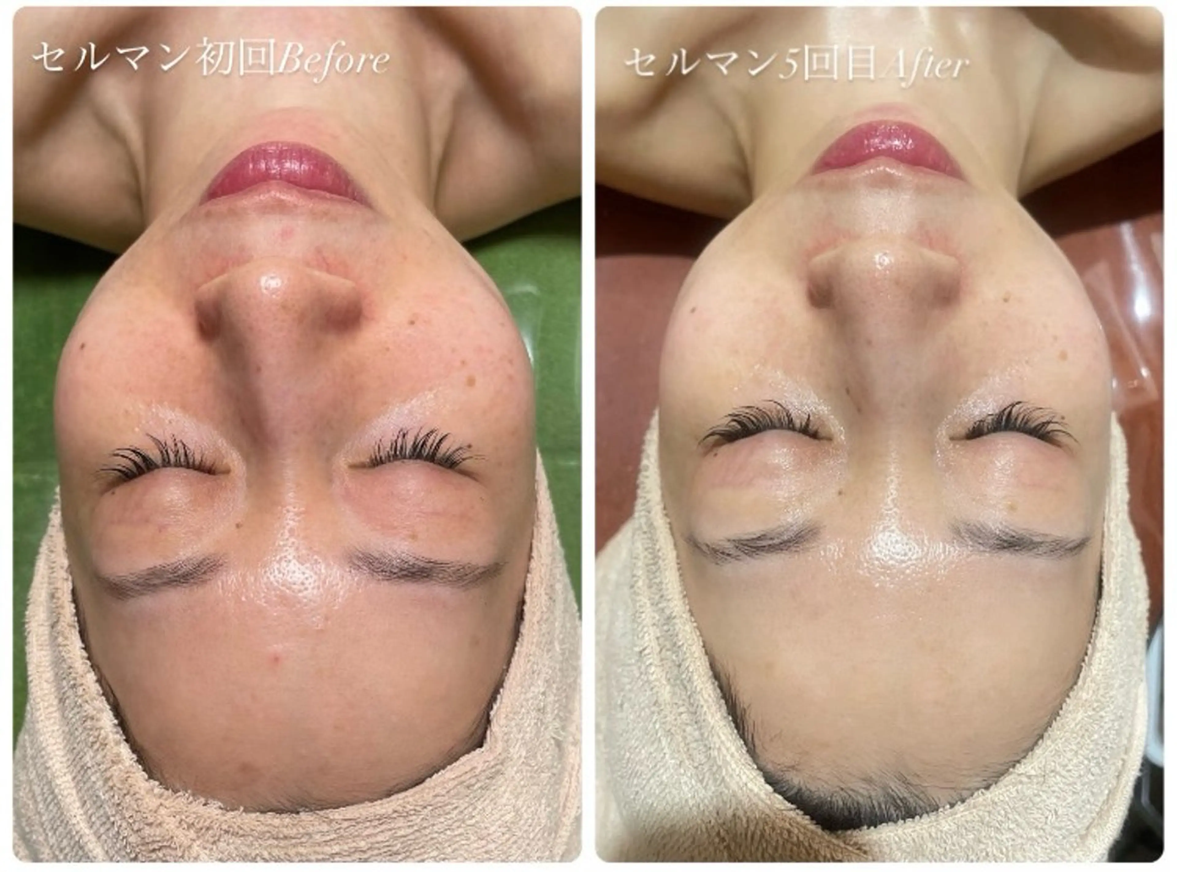 エステ サロンド ポラリスのエステ・リラクイメージ