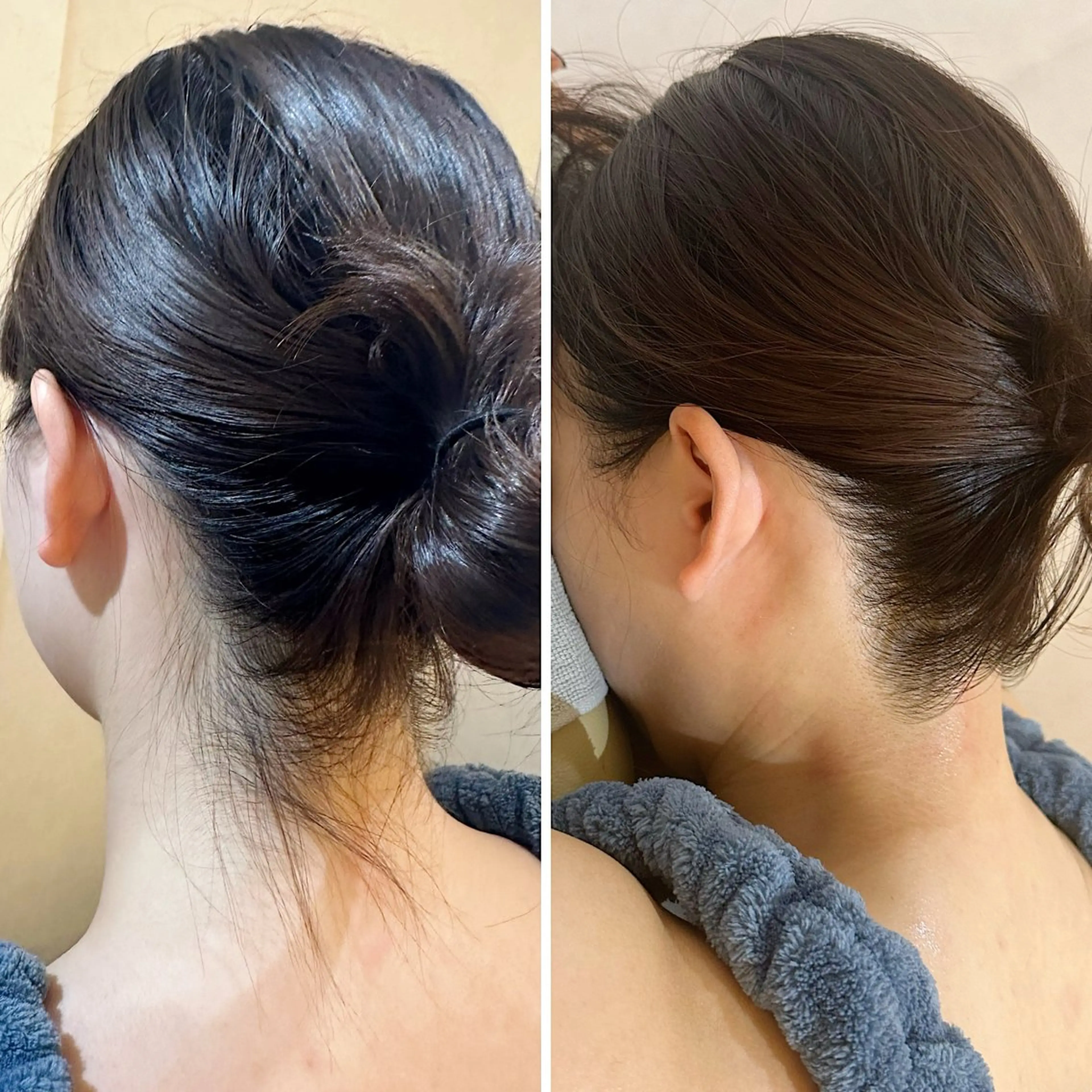 脱毛 うなじ脱毛/美肌脱毛 LABELのエステ・リラクイメージ