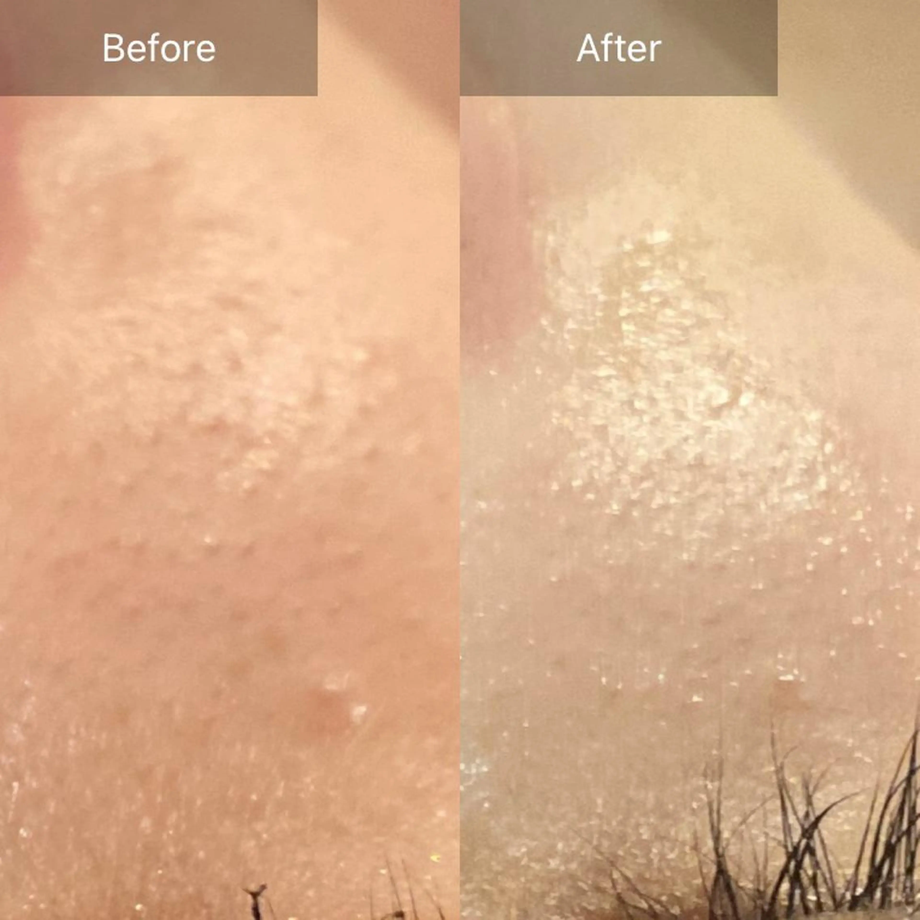 Mandarin Orange所属・毛穴から始める肌メン テマンダリンオレンジのエステ・リラクイメージ