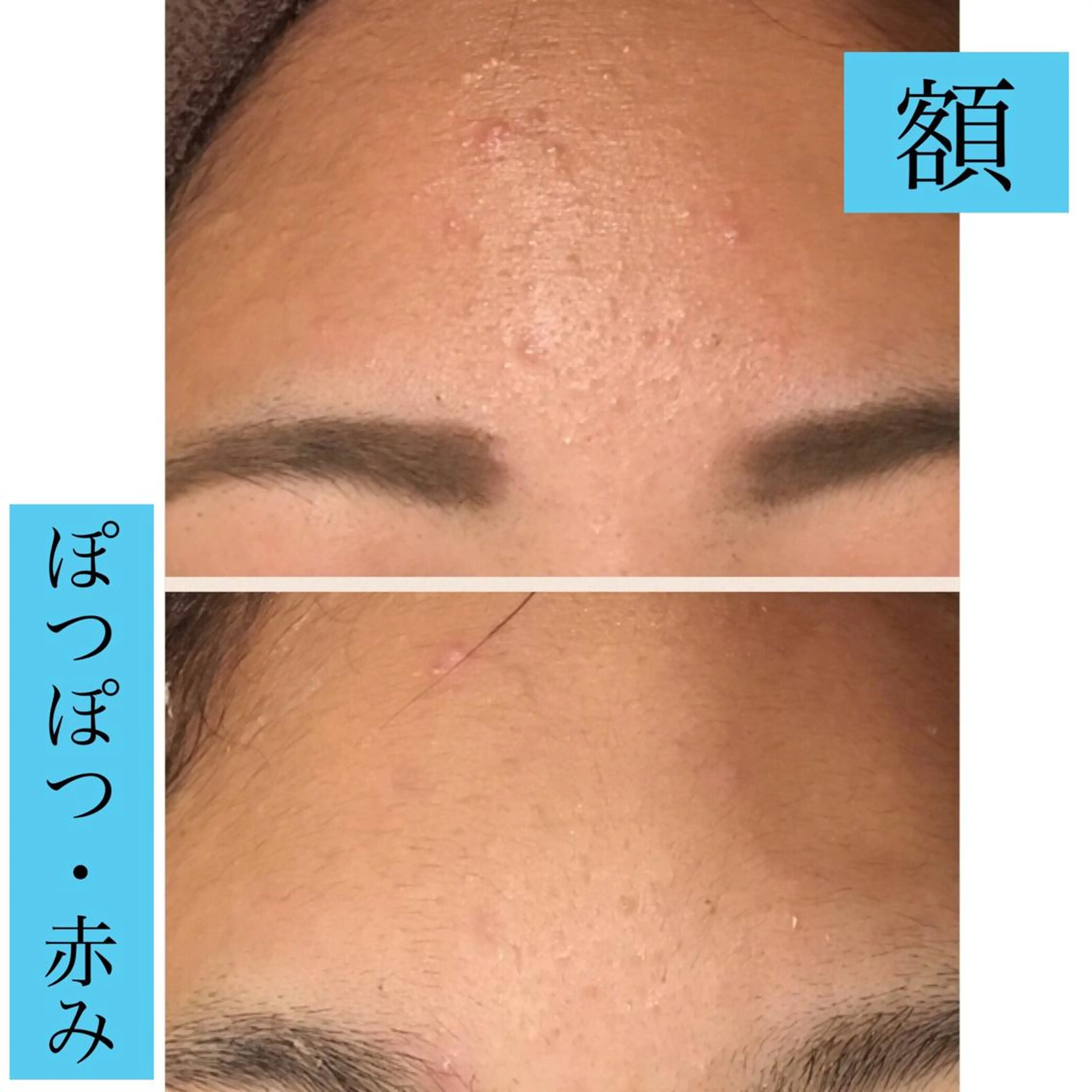 セミロング カラー パーマ ヘアアレンジ メンズ キッズ ネイル マツエク・マツパ 金の糸脱毛 産毛ケア専門のエステ・リラクイメージ