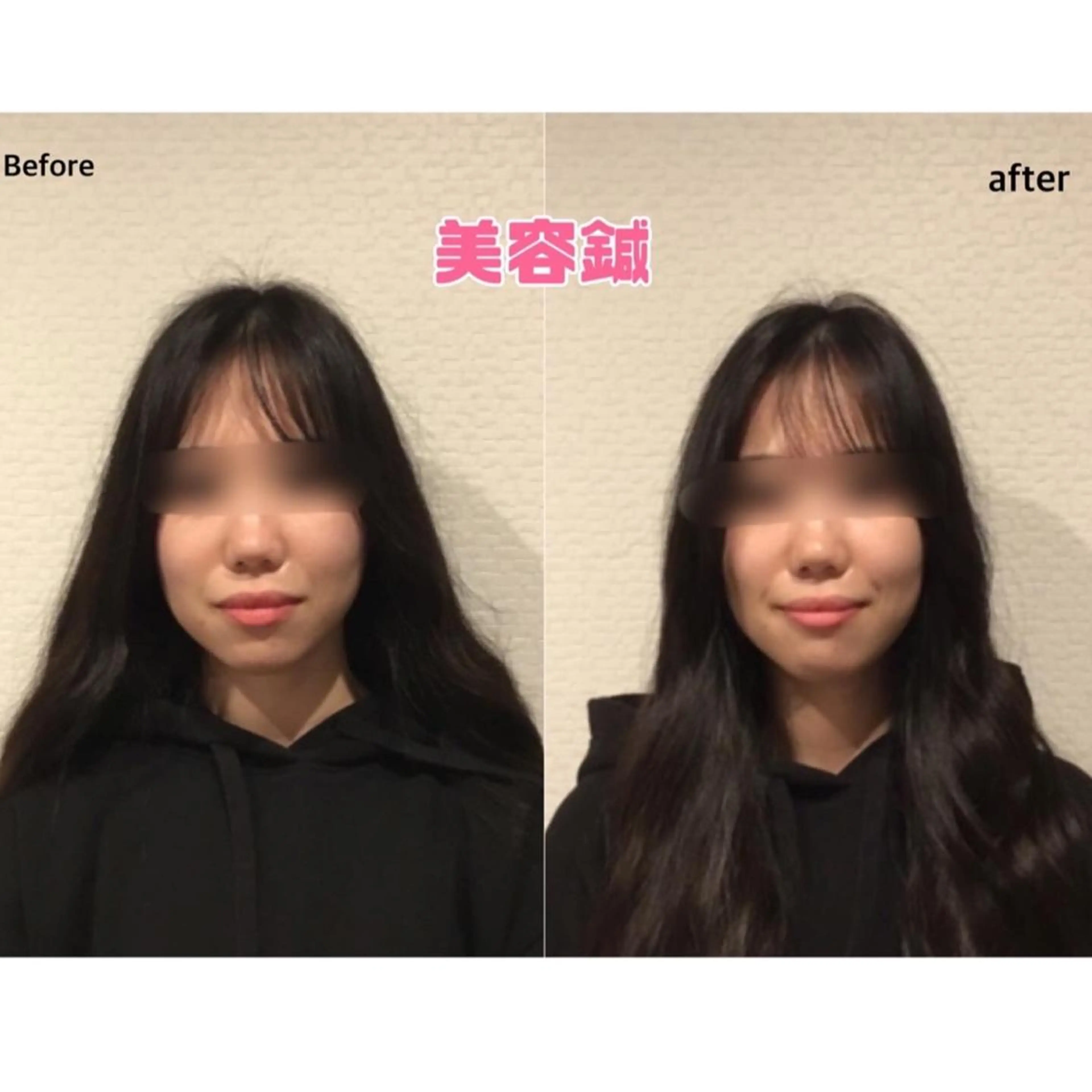 チキバン美容鍼灸整体 サロン心斎橋店のエステ・リラクイメージ