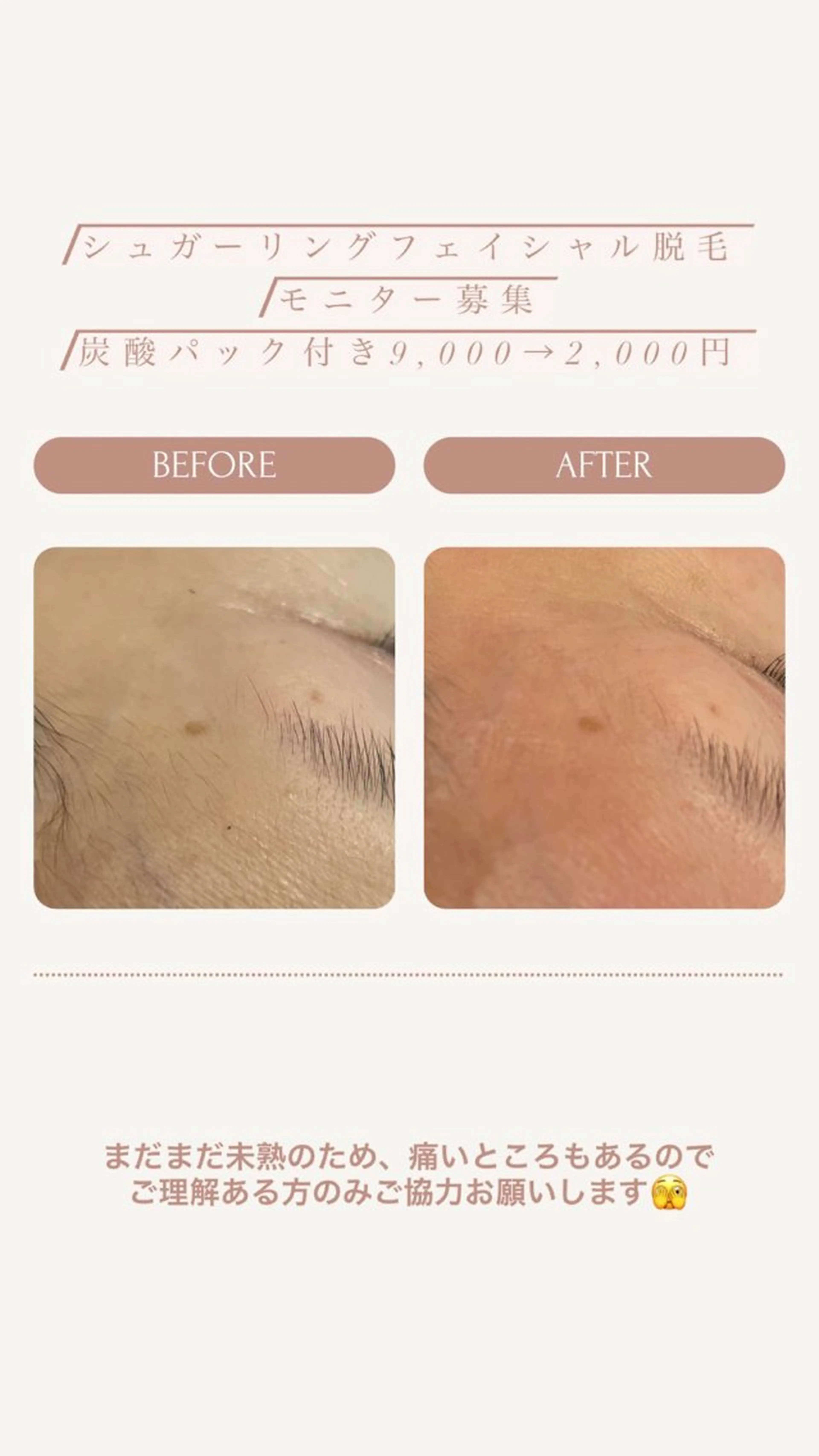 tliengle ［ﾄﾘｱﾝｸﾞﾙ］のネイルデザイン