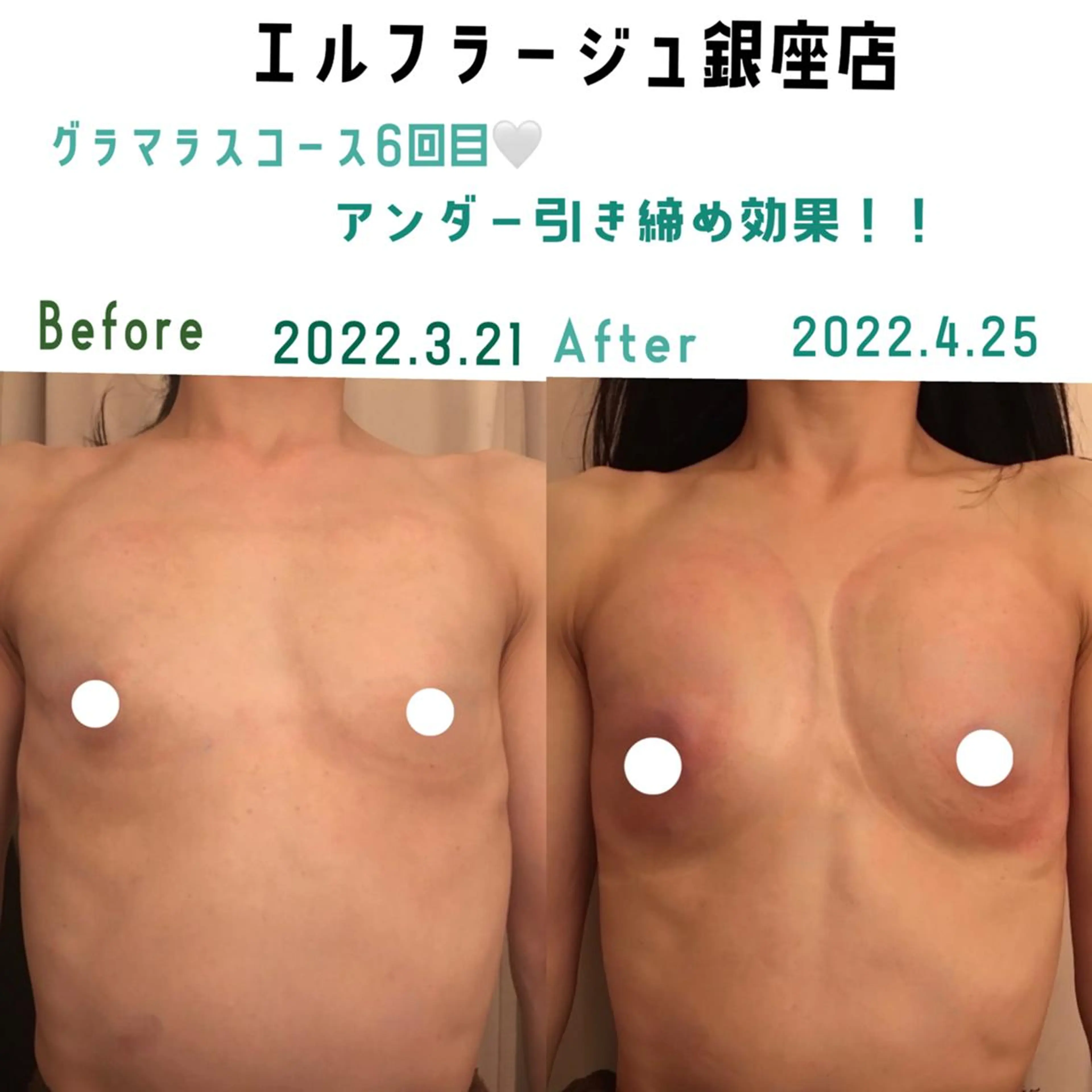 エルフラージュ 銀座店のエステ・リラクイメージ