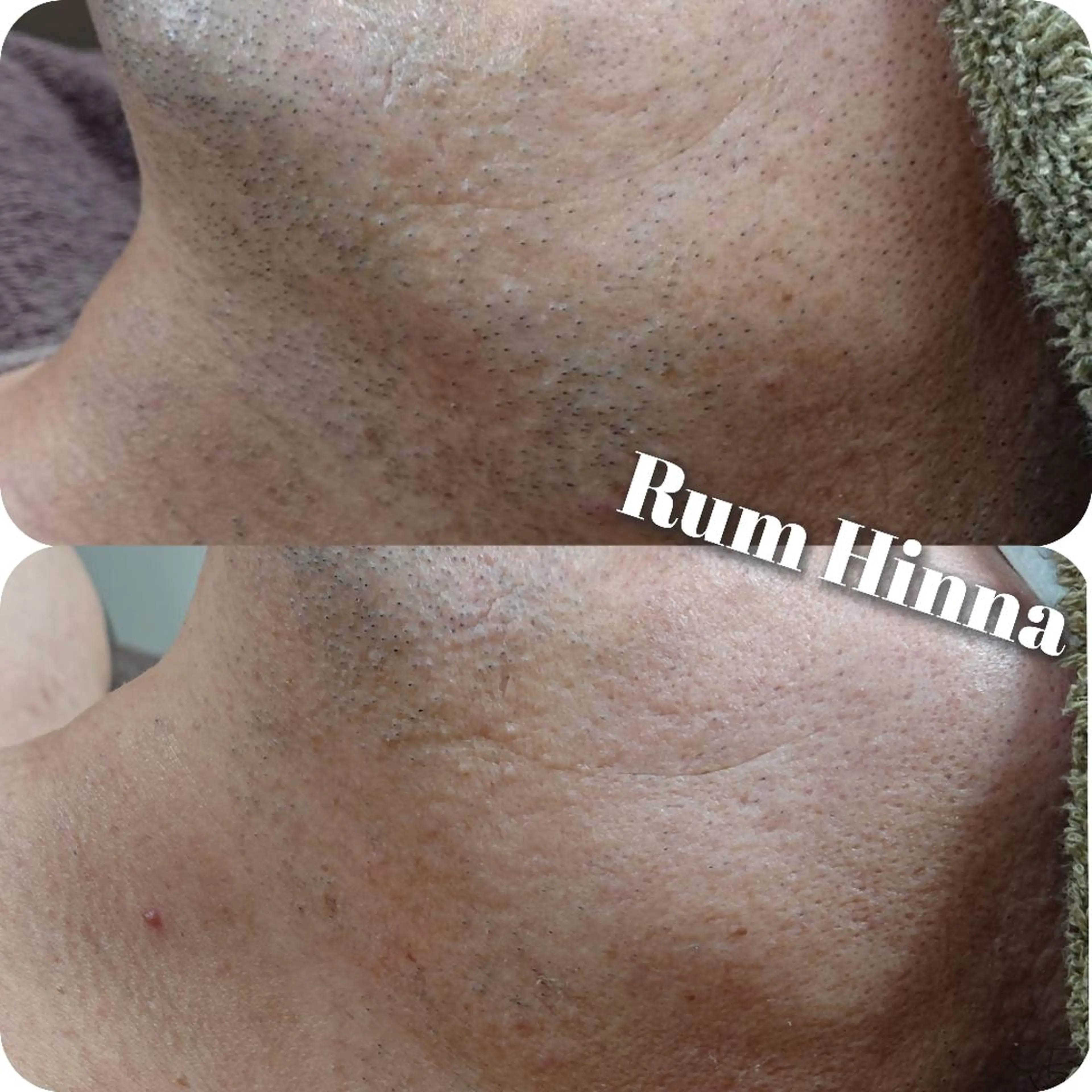 Rum Hinna ラムヒンナーのその他イメージ