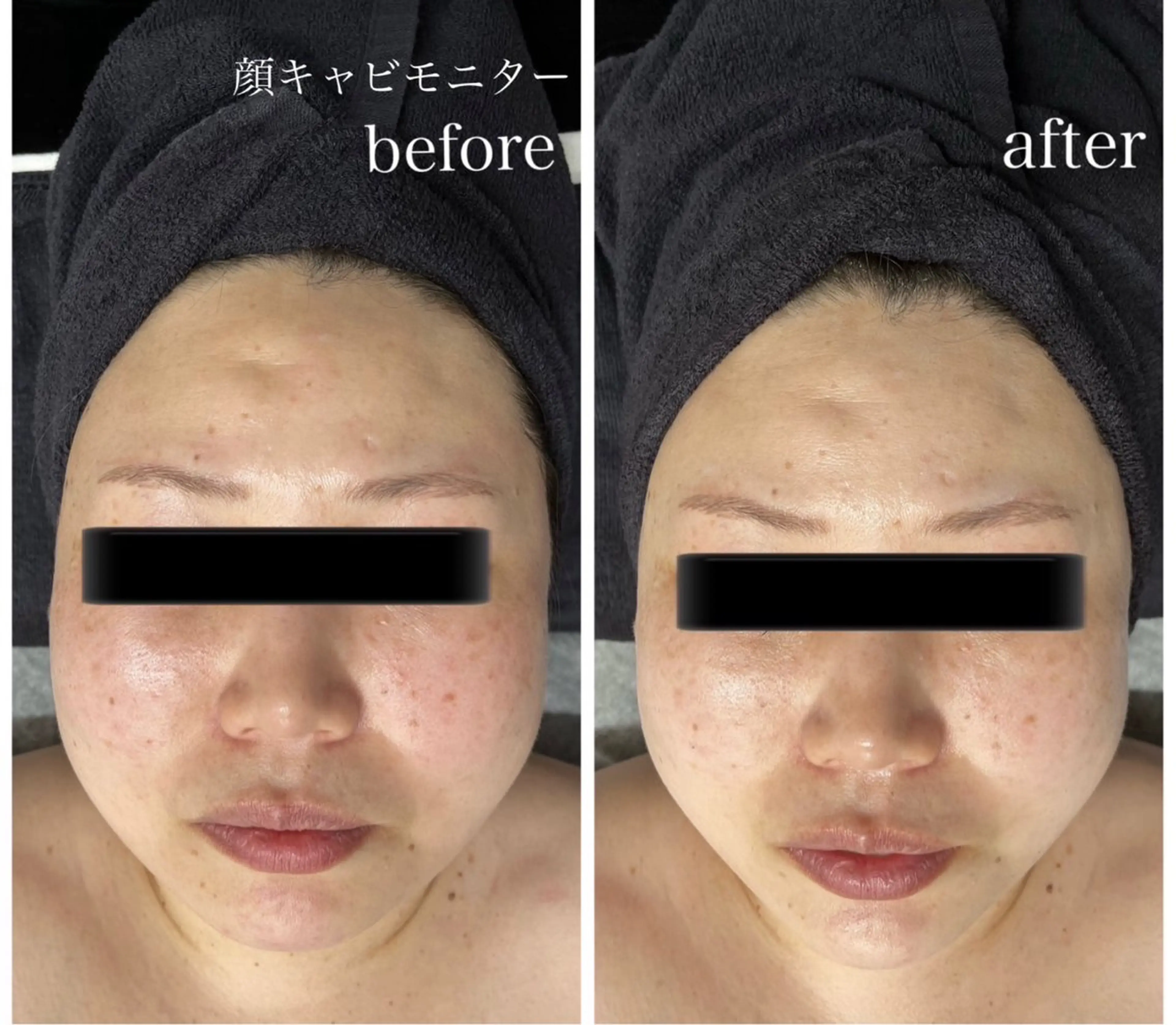 Genesis Plus大津京店のネイルデザイン