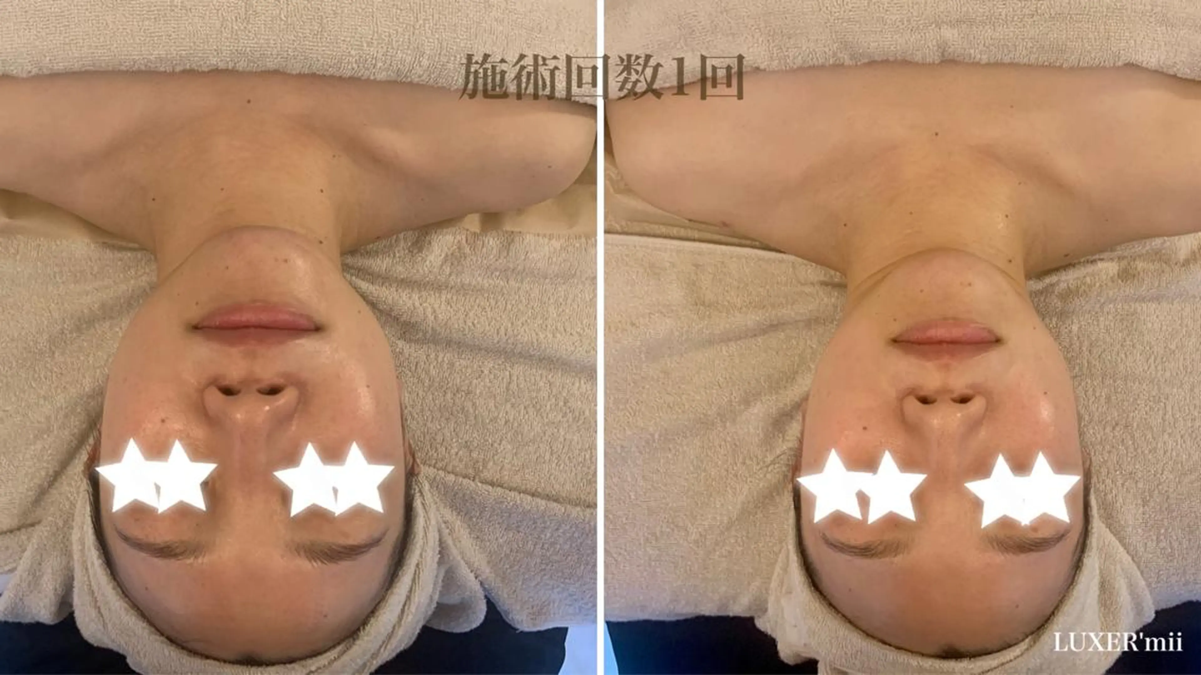 小顔コルギ miiのエステ・リラクイメージ