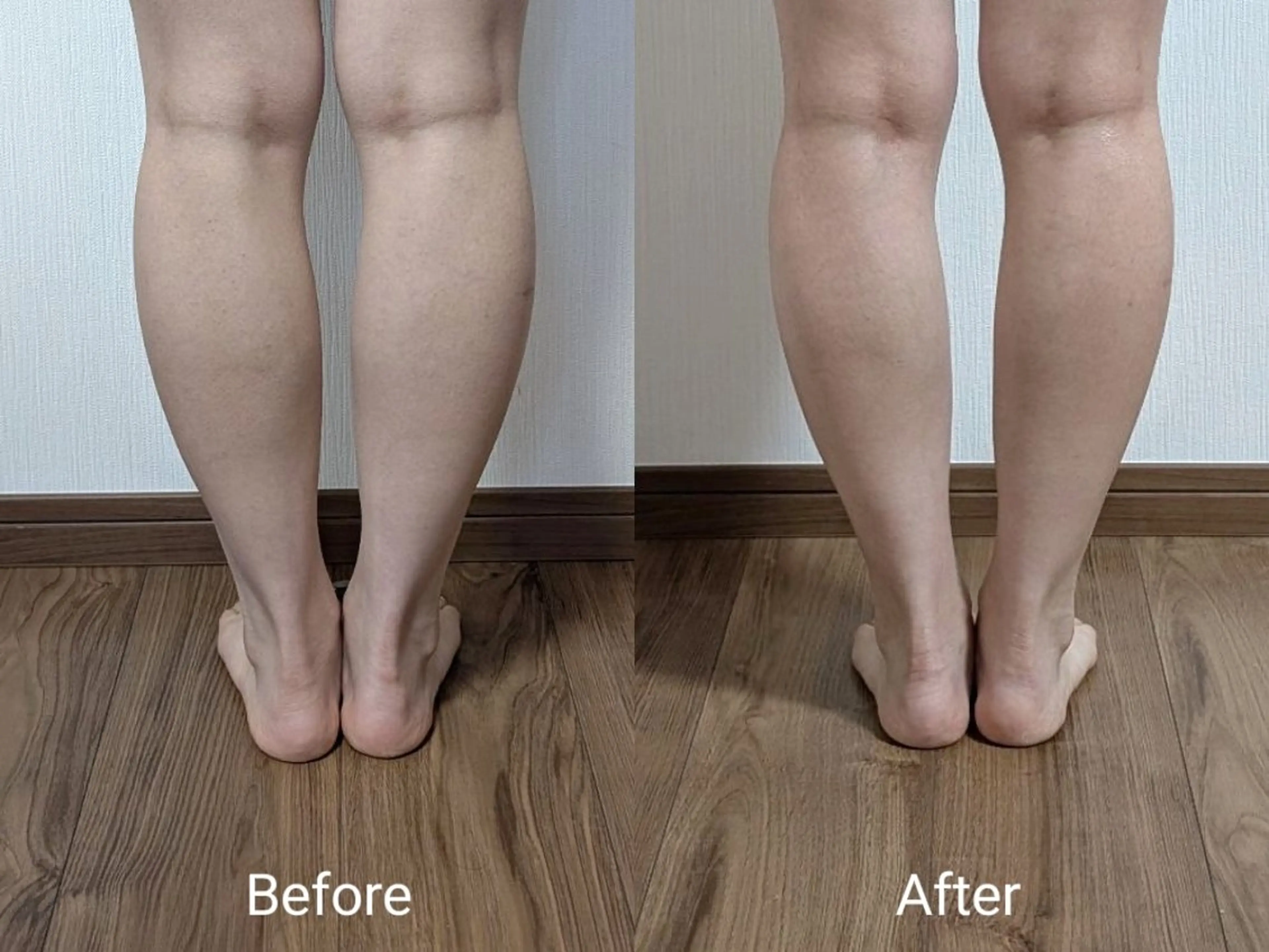 エステ nail RiRi アトレナチュラのエステ・リラクイメージ